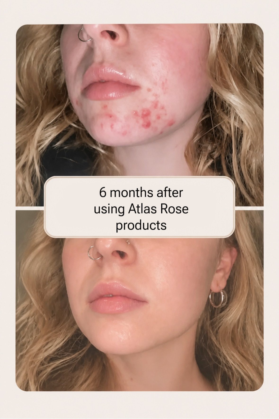 Atlas Rose - All Natural & Organic Luxury Skincare Line