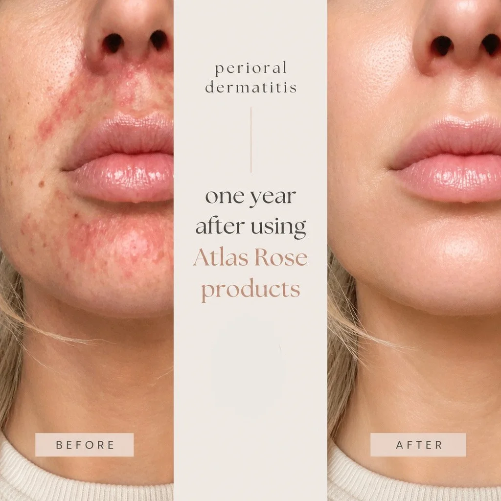 Atlas Rose - Canadian Natural & Organic Skincare