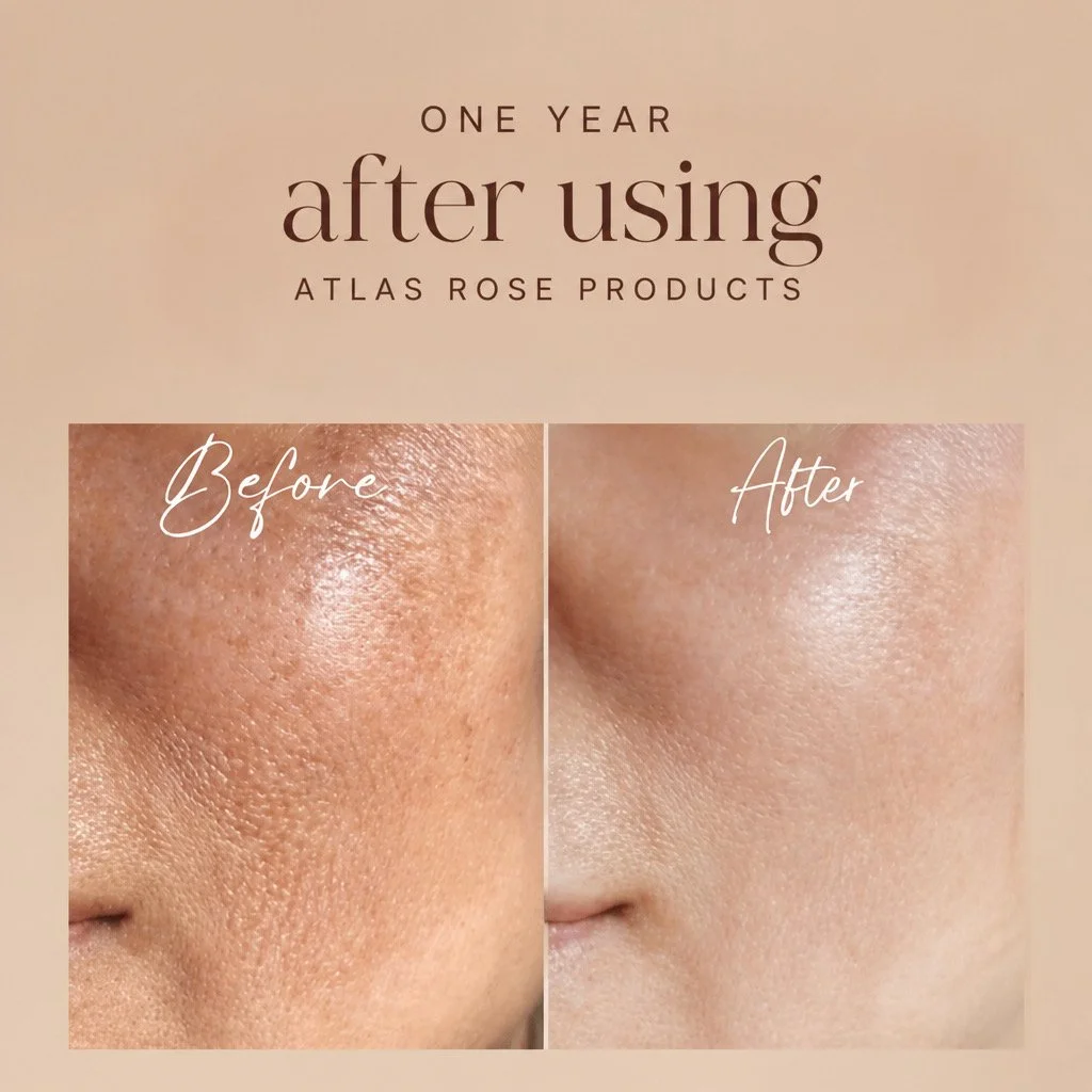 Atlas Rose - Natural & Organic Skincare