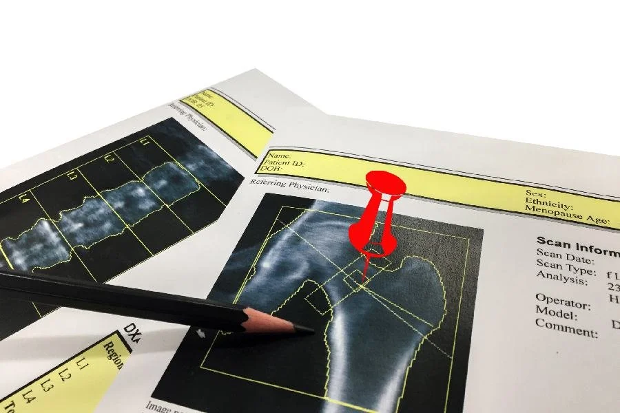 Everything You Need to Know Magnesium IV Therapy — The Drip IV