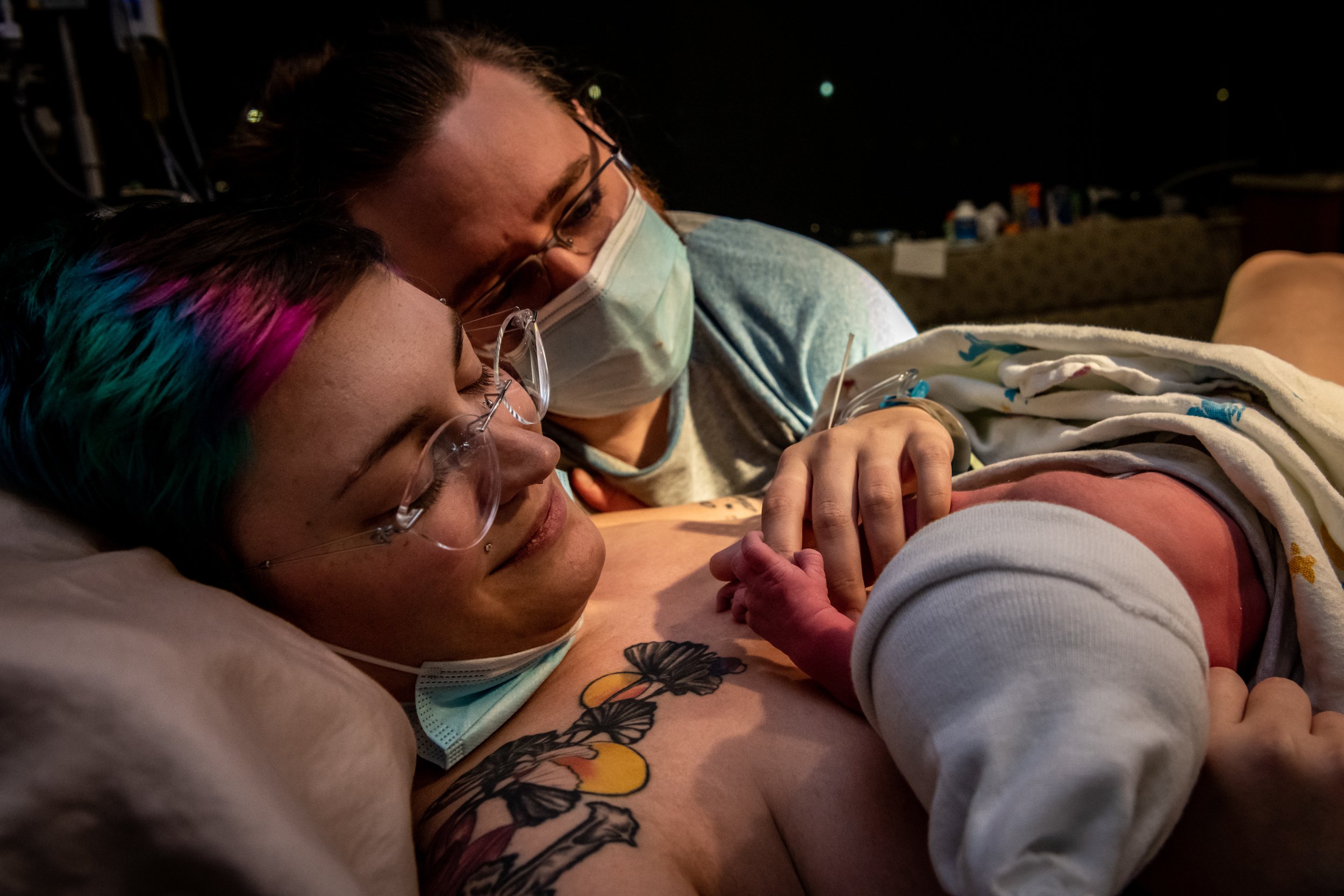 Do Doulas Work With Epidurals?