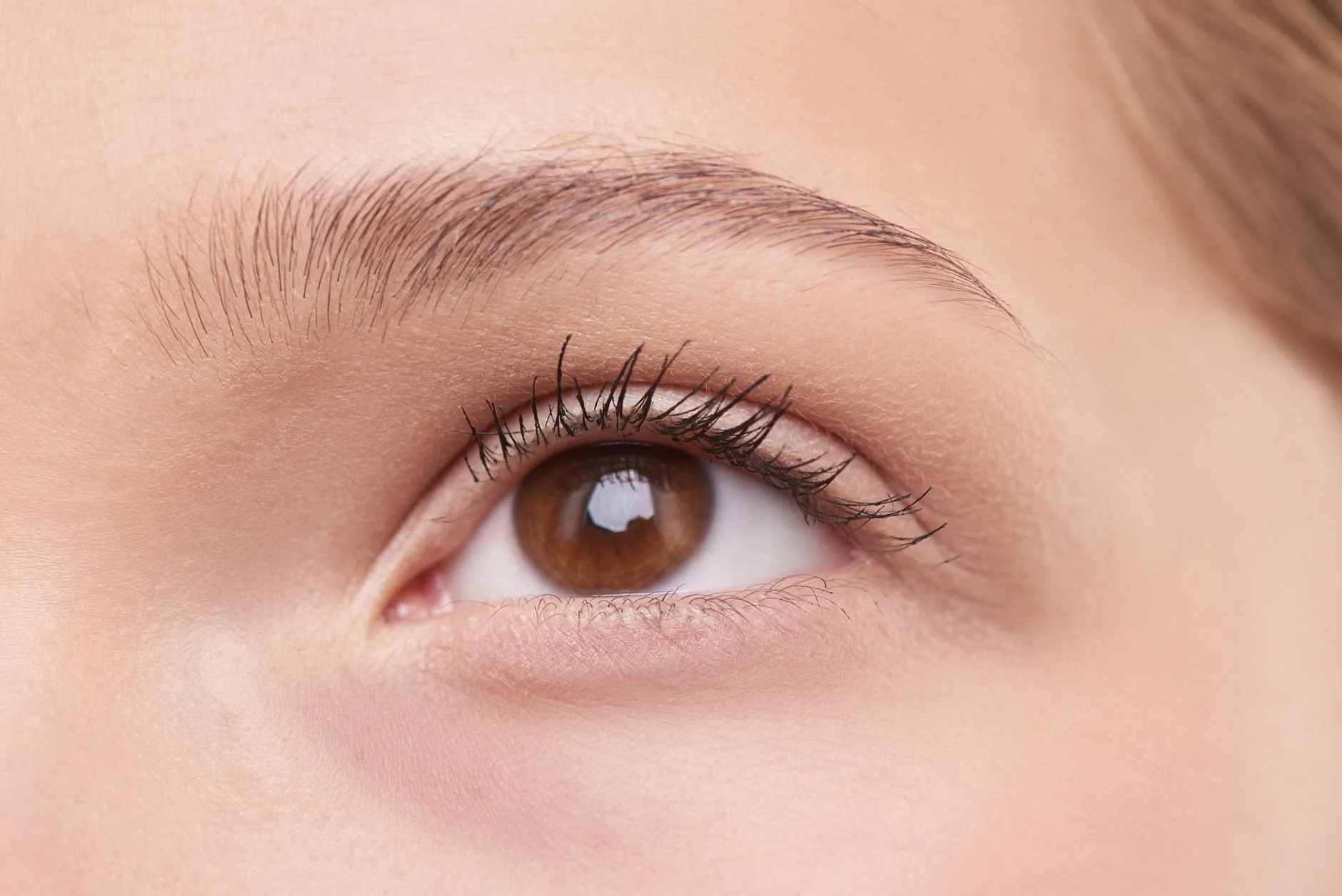 Endoscopic vs Open Brow Lift: Which Technique Is Right for You?