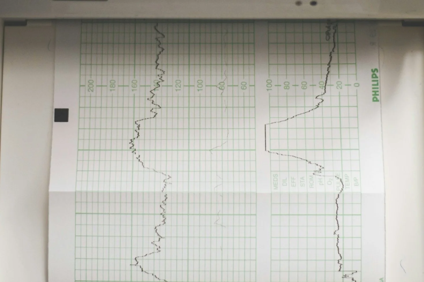 Cardiology services assess heart conditions, measure heart health at our private medical centre berkshire, England