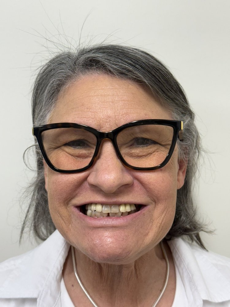 Before: patient smiling before treatment
