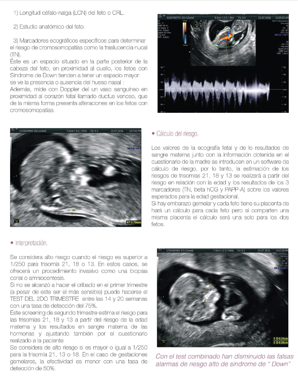 Dr Carlos Ultrasonido Genetico Primer Trimestre Triple Screening