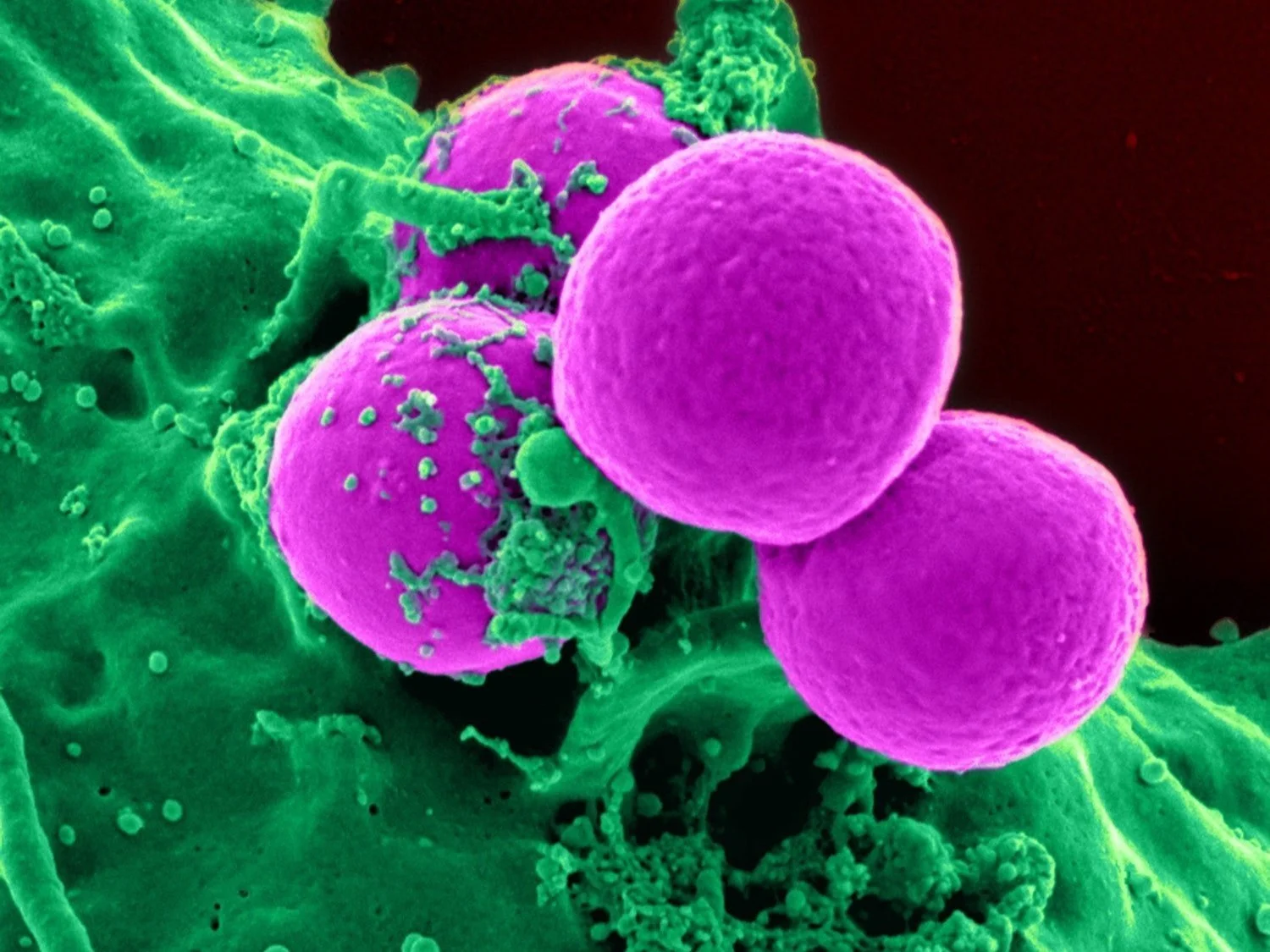 Unmasking Autoimmune Diseases 