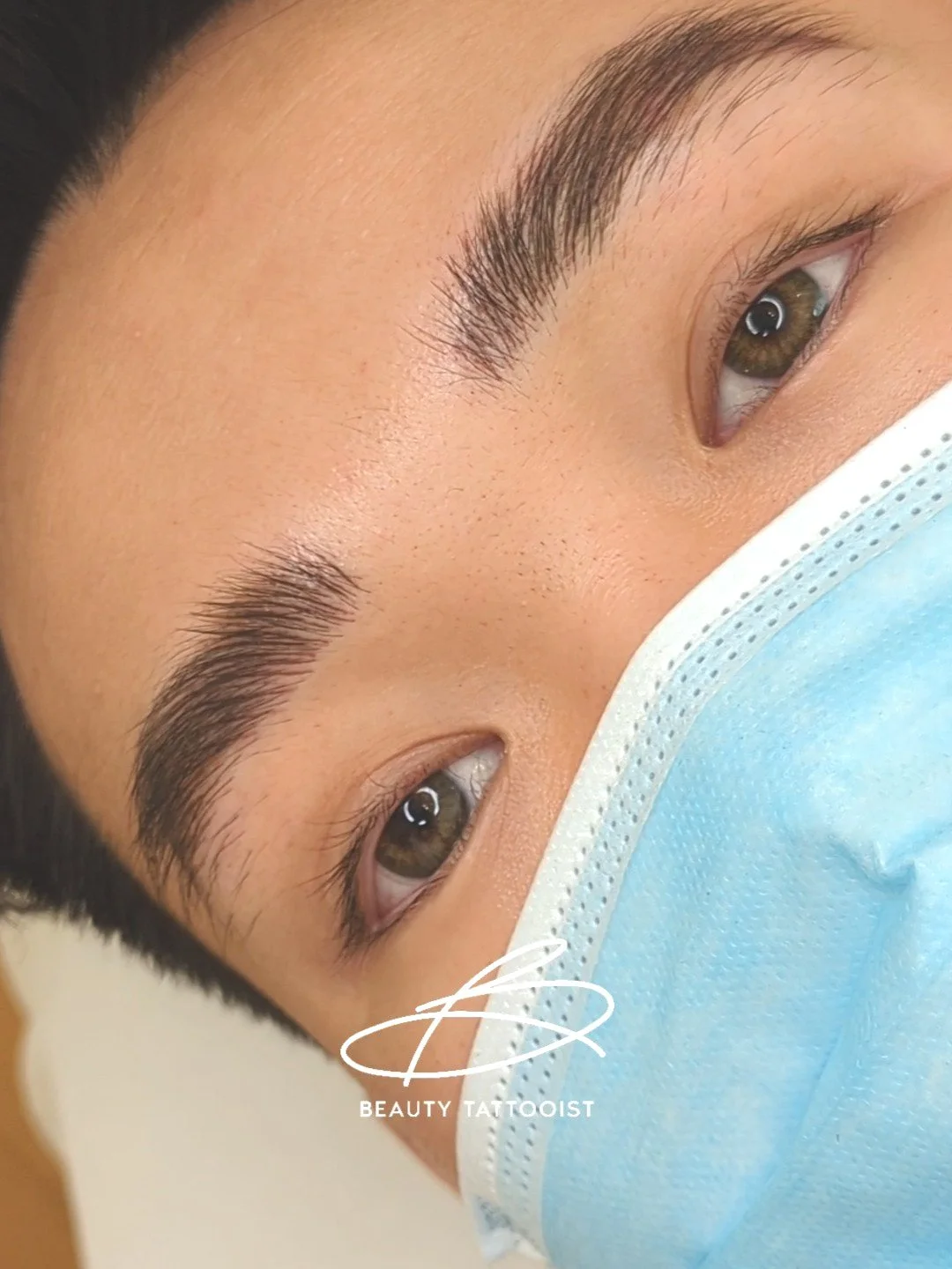 Eyebrow Hair Loss in Men And What You Can Do