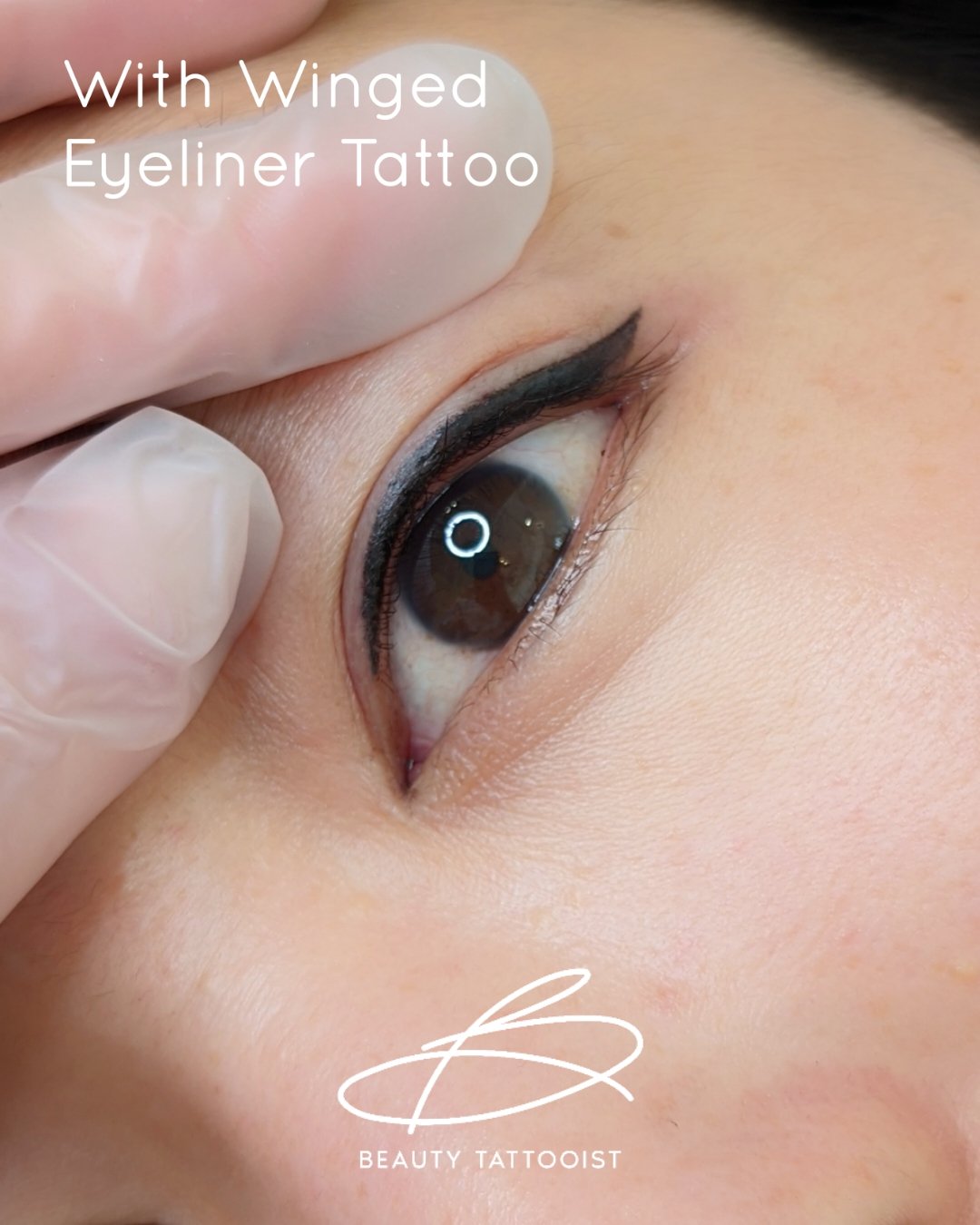 Eyebrow Laser Tattoo Removal Vancouver | Permanent Makeup