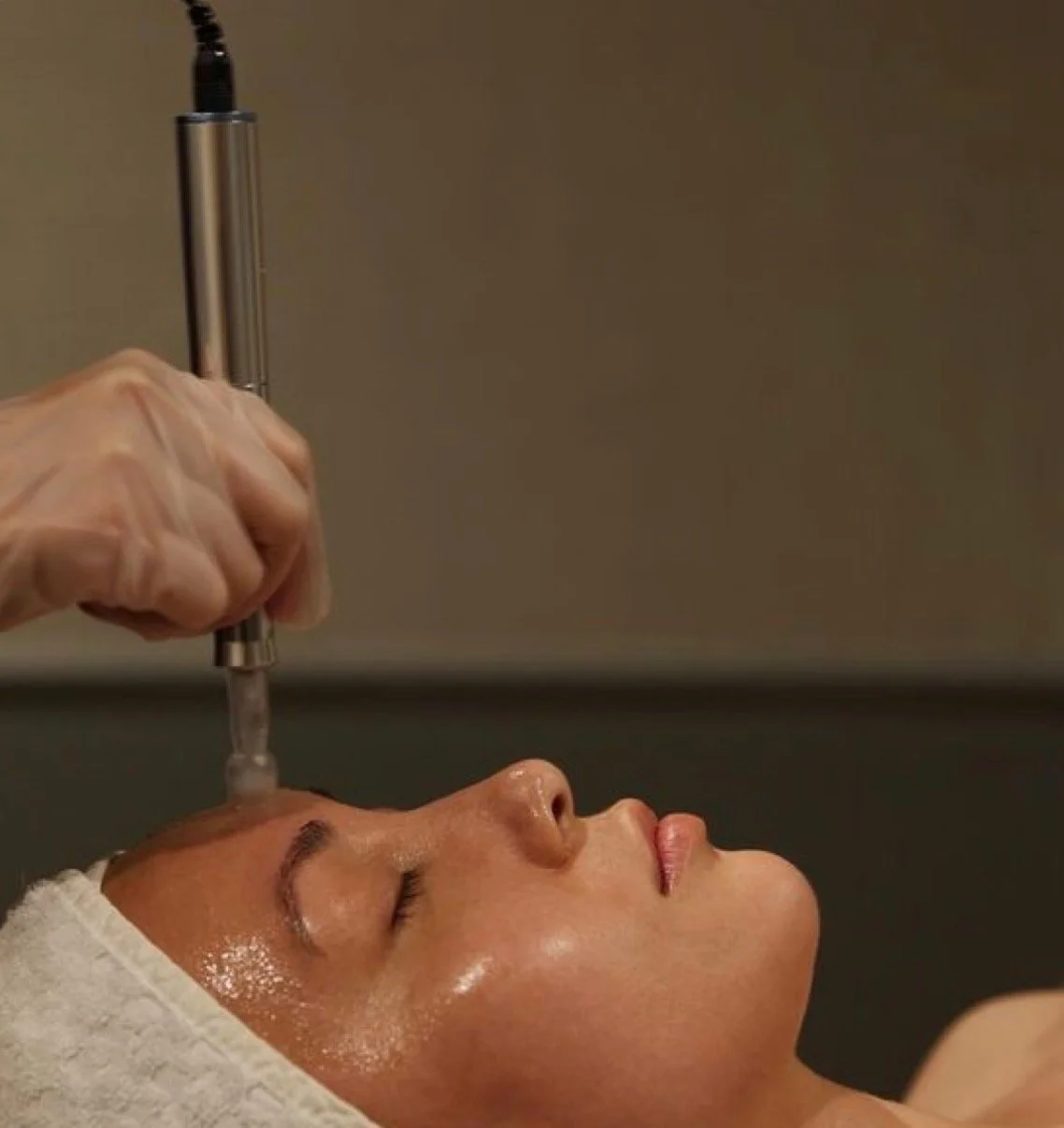 3 x Skin Needling Winter Offer