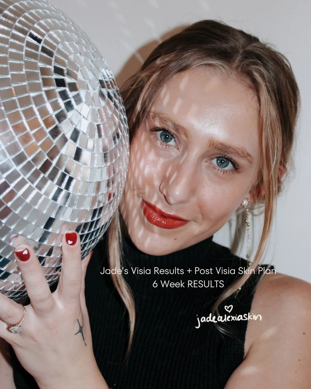 Jade&rsquo;s VISIA skin analysis results &mdash; baseline, plan, and progress ✨

At 22, the focus is prevention and optimization. Her VISIA scan showed opportunities to improve pore size, porphyrins (bacteria + oil in the pores), and under-eye dehydr