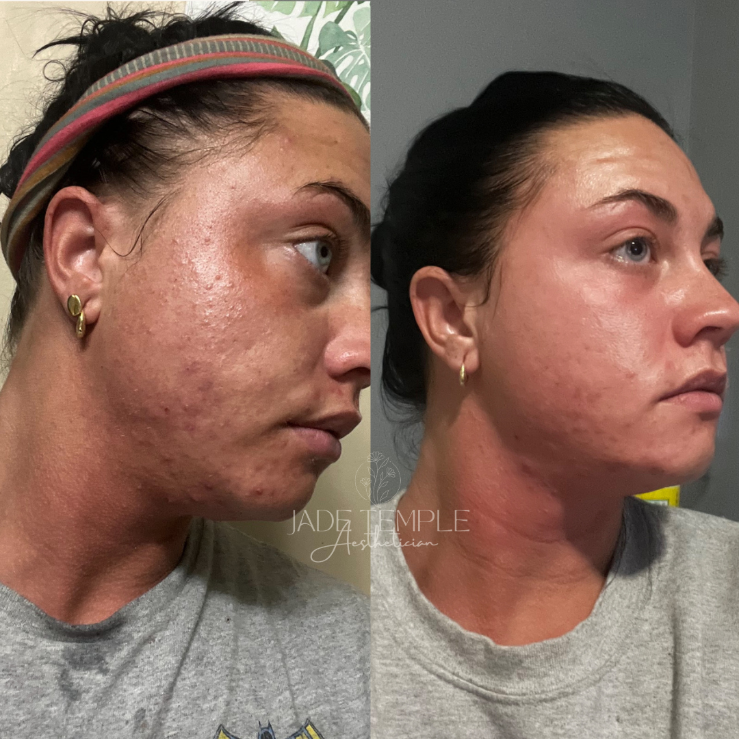 Emma Goodloe- Complex A Bootcamp.png