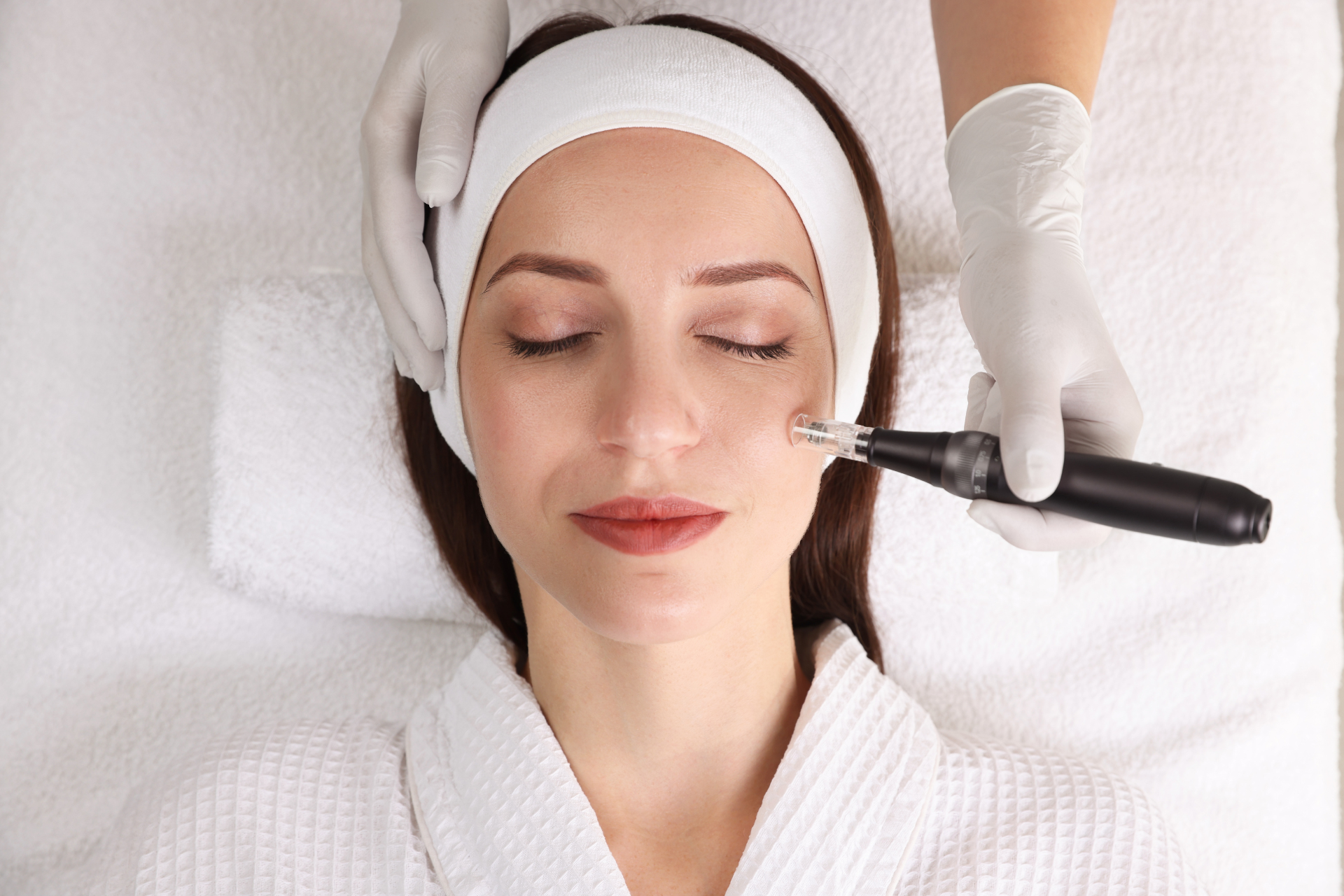 RF Microneedling vs Chemical Peels 