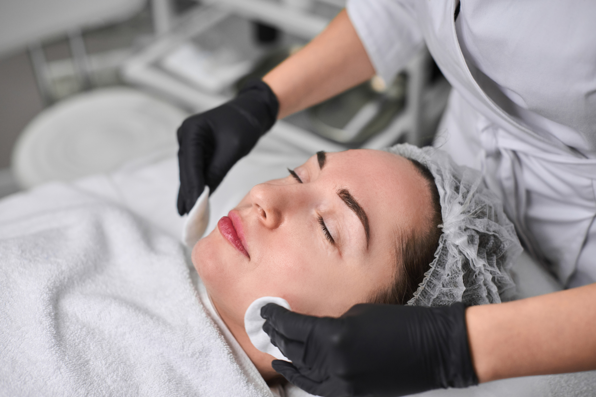 Best Treatments for Acne in Thornbury