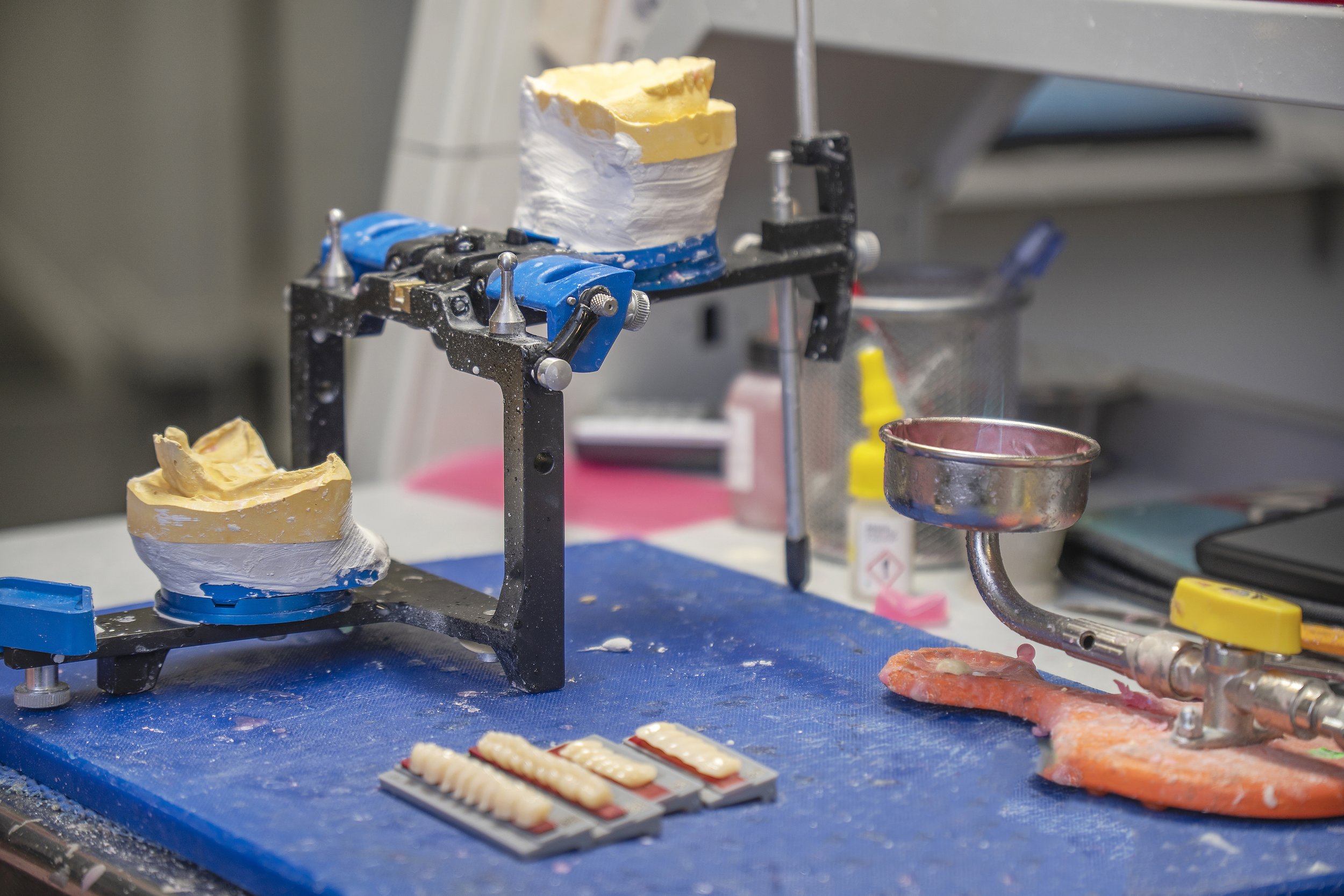 Making a denture at Hamilton Dental &amp; Prosthetics Lab 