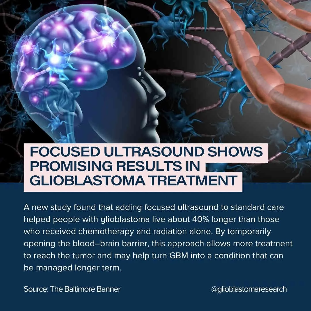 ​Focused Ultrasound Shows Promising Results In Glioblastoma Treatment