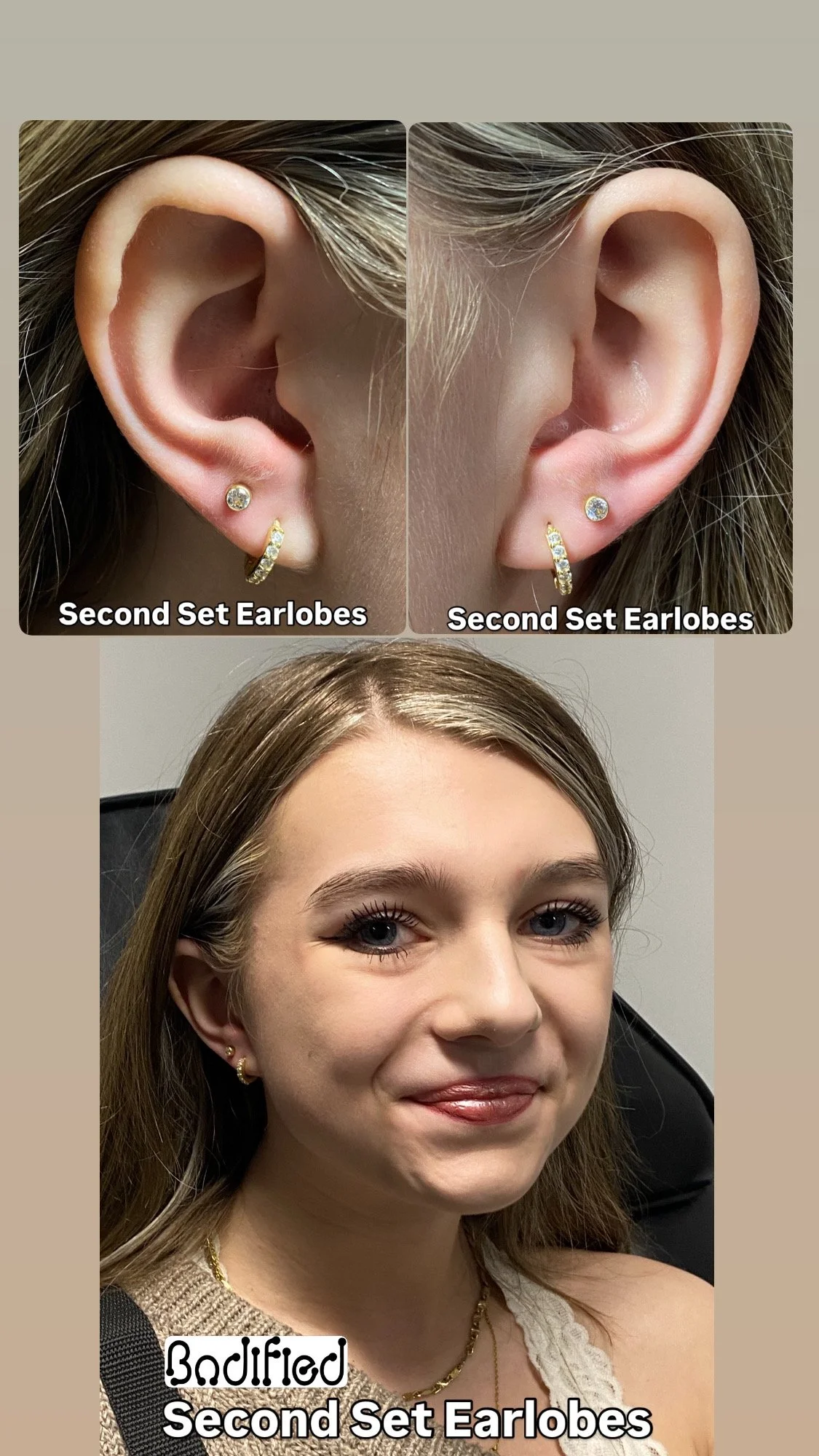 Second Set Earlobes