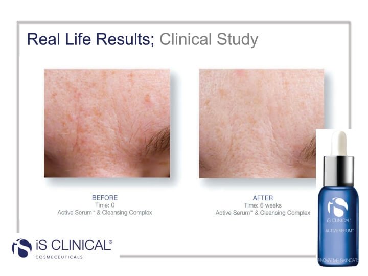 active_serum_before_after_image2.jpg