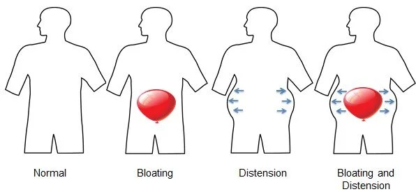 Bloating and distension differences
