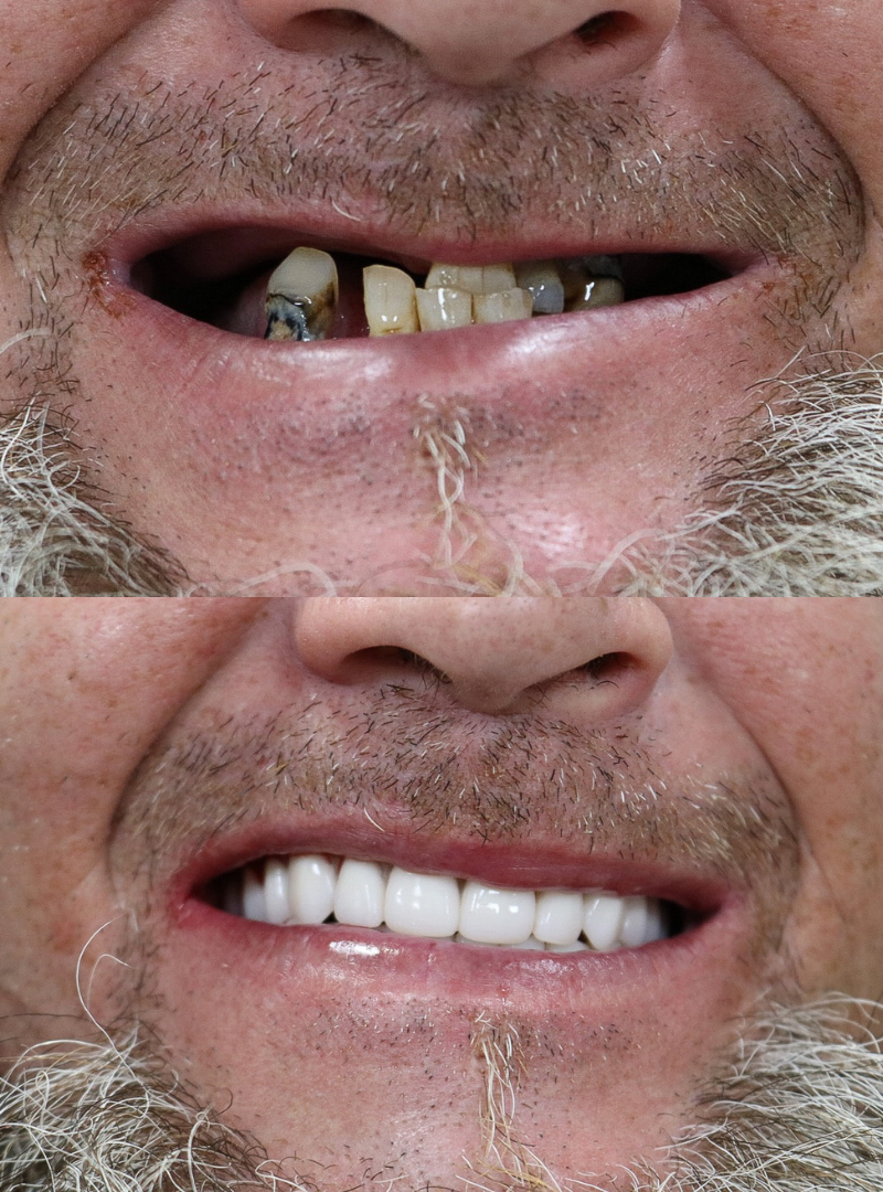 Marble Before And After Lash Tech Instagram Post (1).png