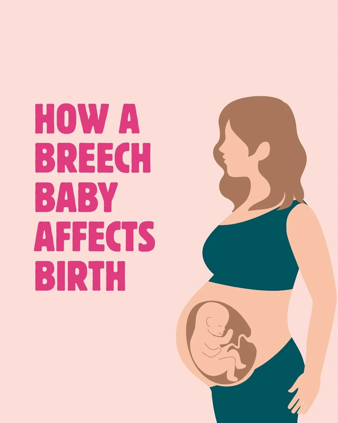 🤰 Let&rsquo;s talk about breech babies!
A &ldquo;breech&rdquo; baby means bub&rsquo;s head is up instead of down in the womb, and while this can be completely normal early in pregnancy, it may cause some extra challenges as your due date approaches.