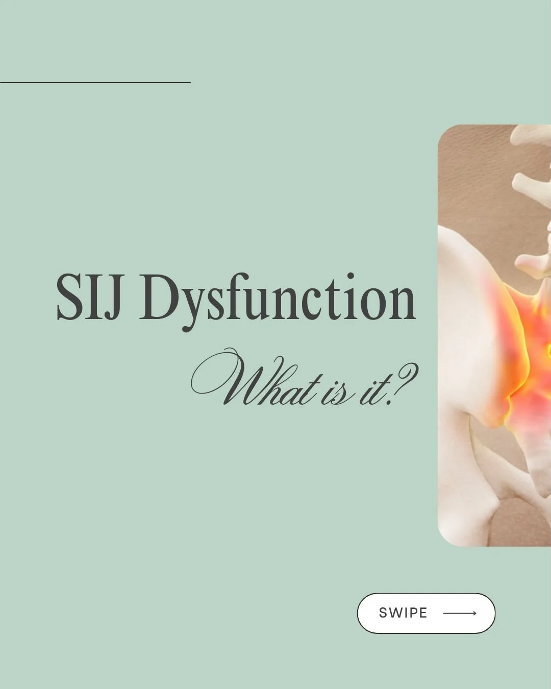 What is your SIJ? 

SIJ or Sacroiliac Joint pain often presents as lower back or hip pain and is a common injury we treat in clinic. 

Common with lifting or running sports, and in pregnancy. Any questions? Let us know. 

#sij #pain #chiro #treatment