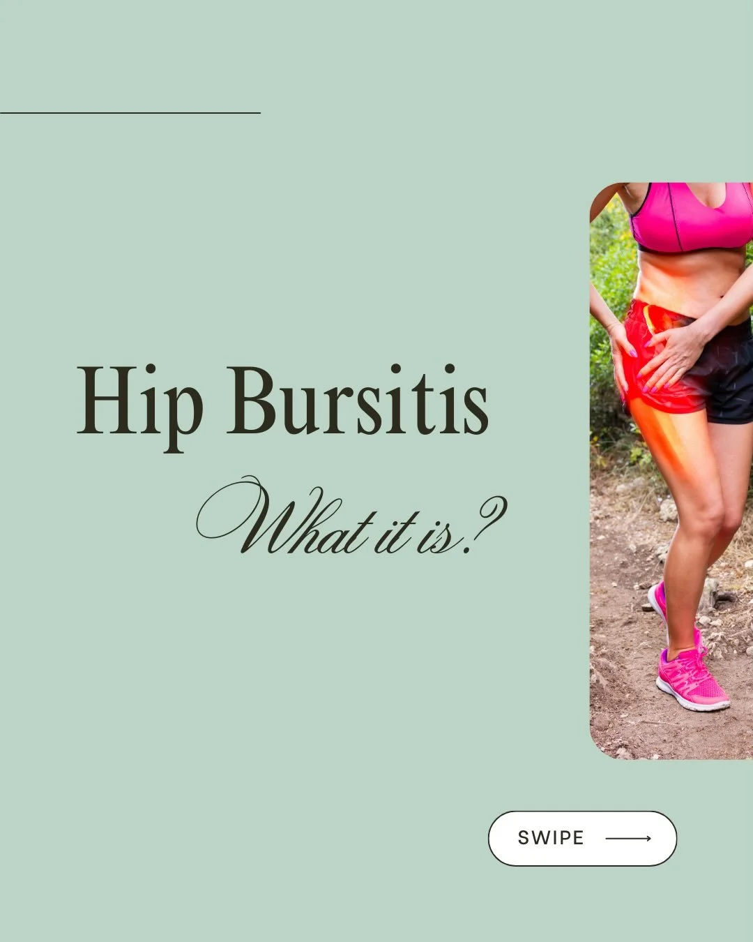 What is Hip Bursitis? 

A very common condition we treat here in clinic. But a bursitis won&rsquo;t occur on its own. There is always something else causing an overload to the bursa. 

That&rsquo;s where our team will conduct an assessment to determi