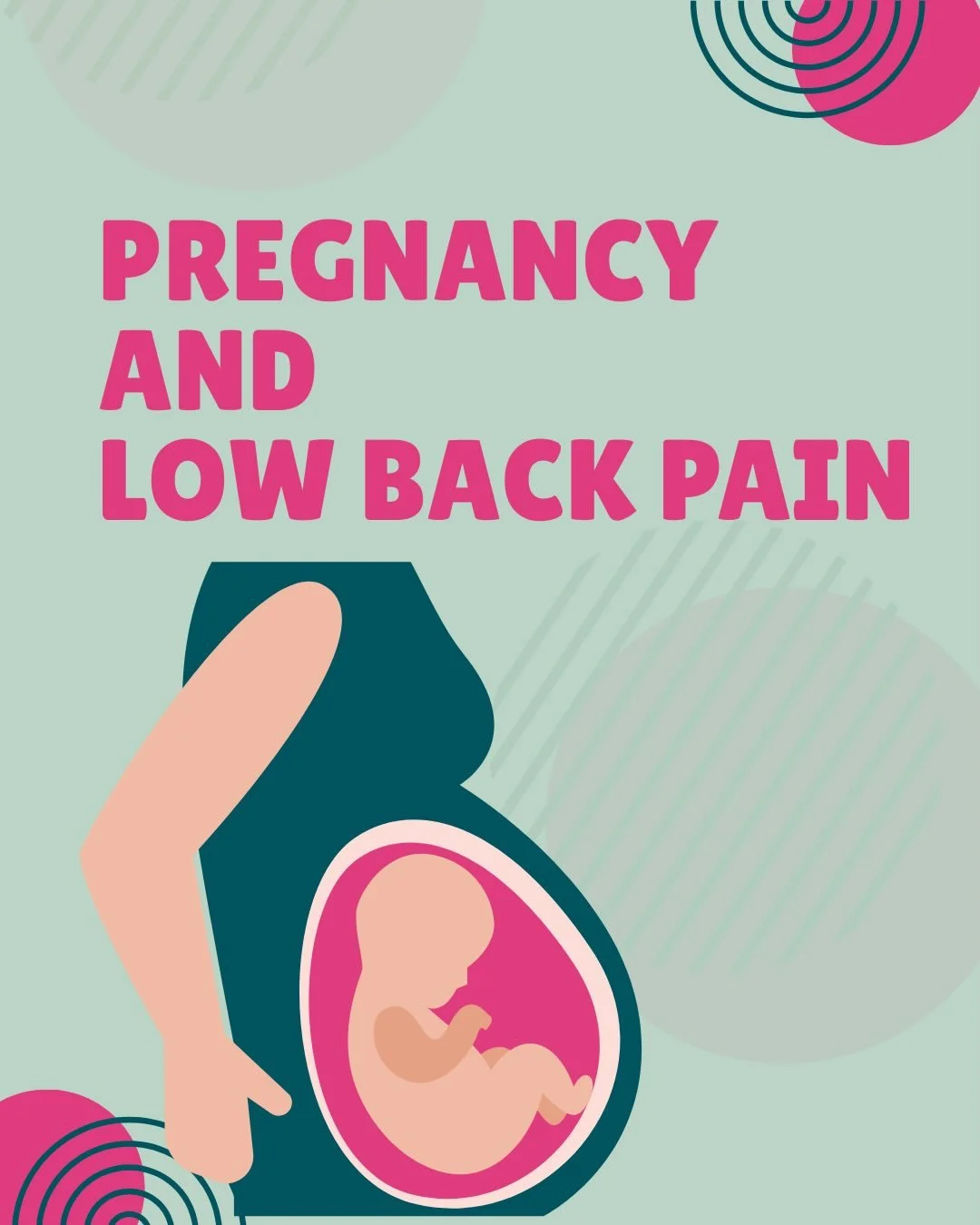 Low back pain with pregnancy? 

It doesn&rsquo;t always have to be &ldquo;normal&rdquo;. Our team work with you as your body develops through pregnancy, to support you and your goals. 

Book in for an assessment to help management any pregnancy disco