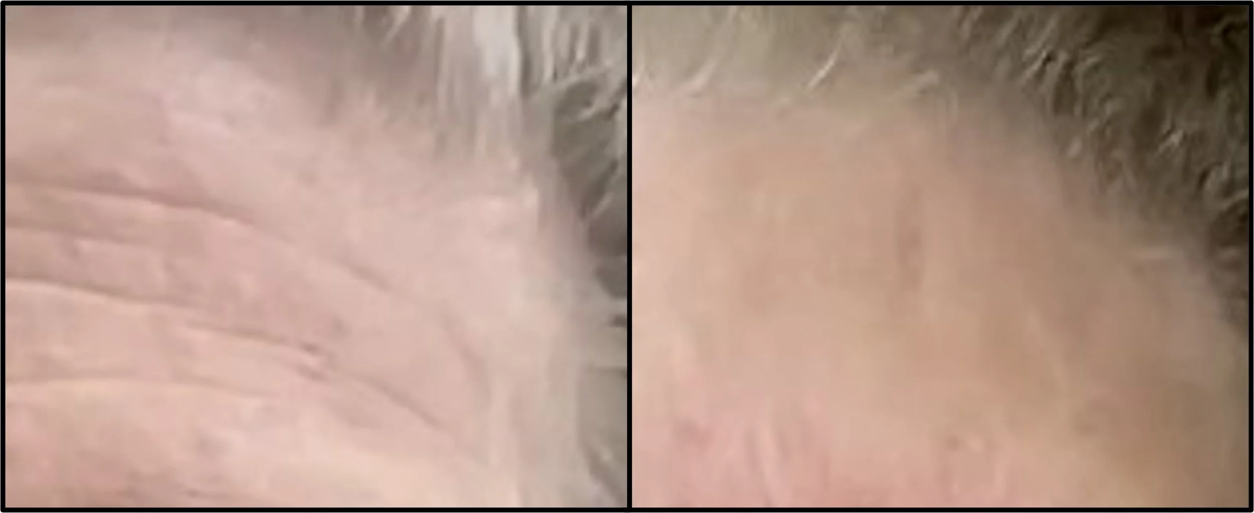 Close-up of a person's hand on their face on the left side, and a close-up of their forehead and eyebrow area on the right side, showing skin and hair.