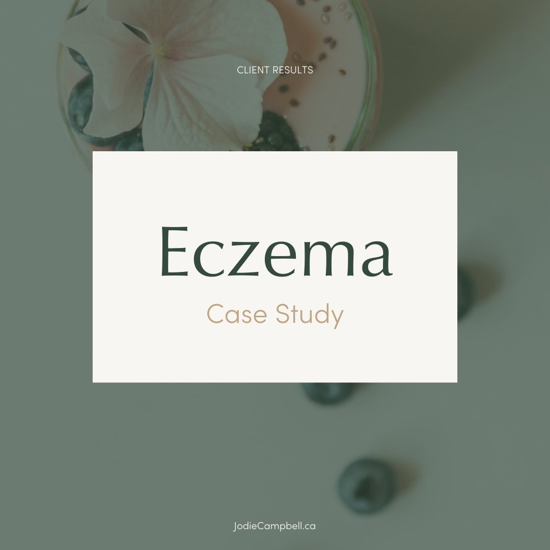 Let's talk eczema &ndash; that annoying itchy skin issue that just won't quit.

But guess what? 

There's a cool connection between your gut and your skin that could hold the key to finally kicking eczema to the curb!

Your gut and your skin are like
