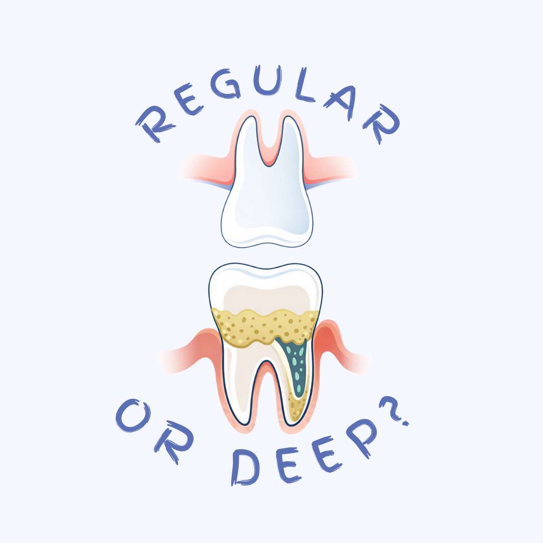 Regular vs “Deep” Dental Cleanings — What’s Really Happening Underneath Your Gums