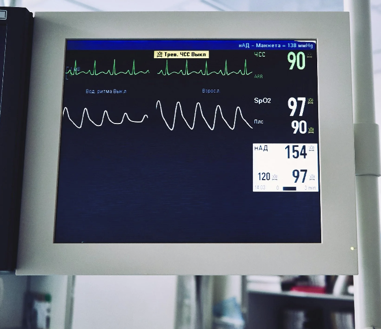A photo of a hospital monitor 