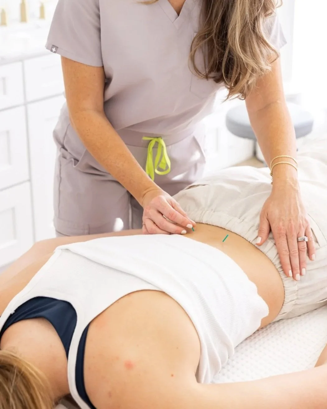 Woman giving acupuncture treatment for lower back pain
