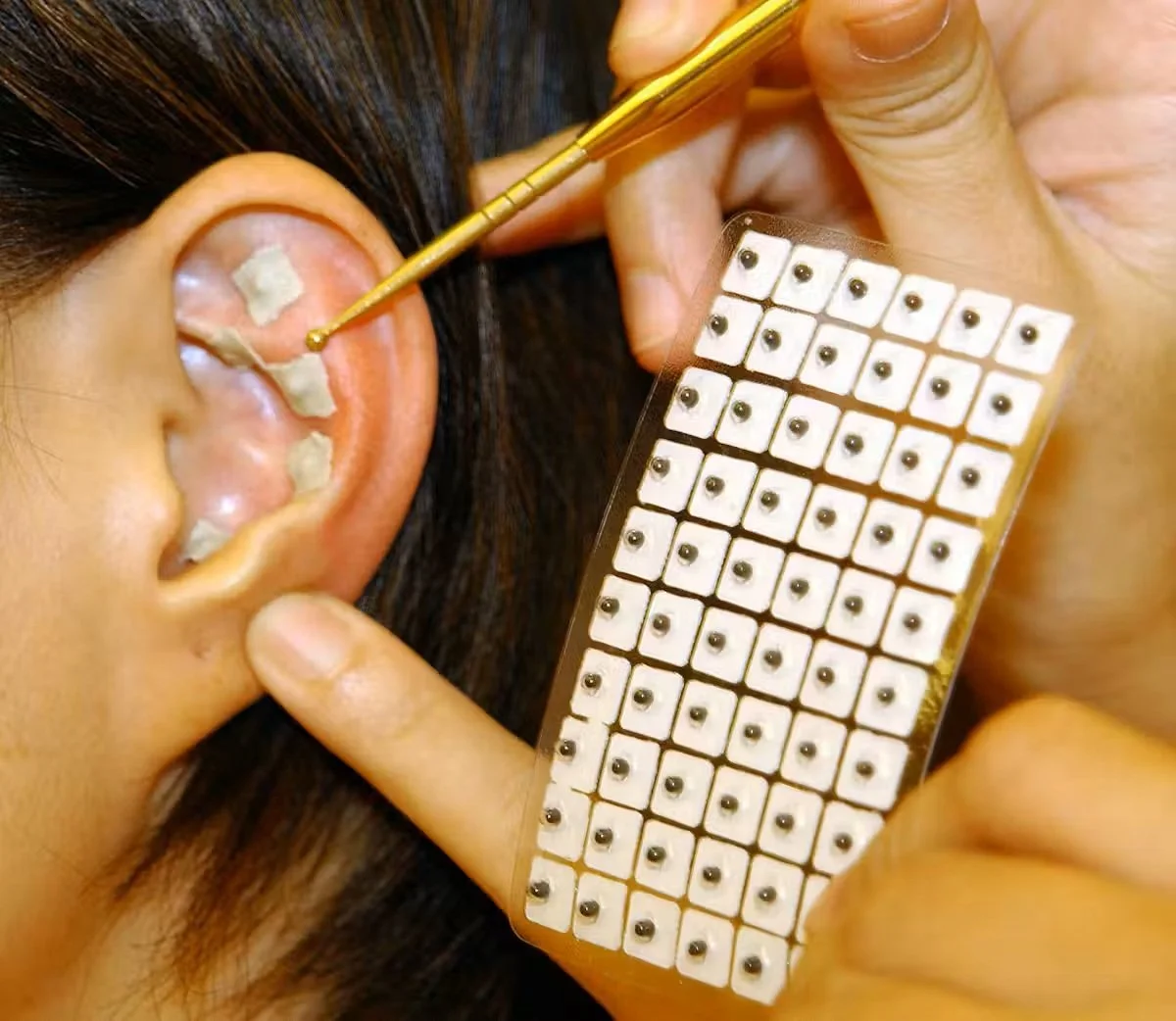 What Are Ear Seeds?