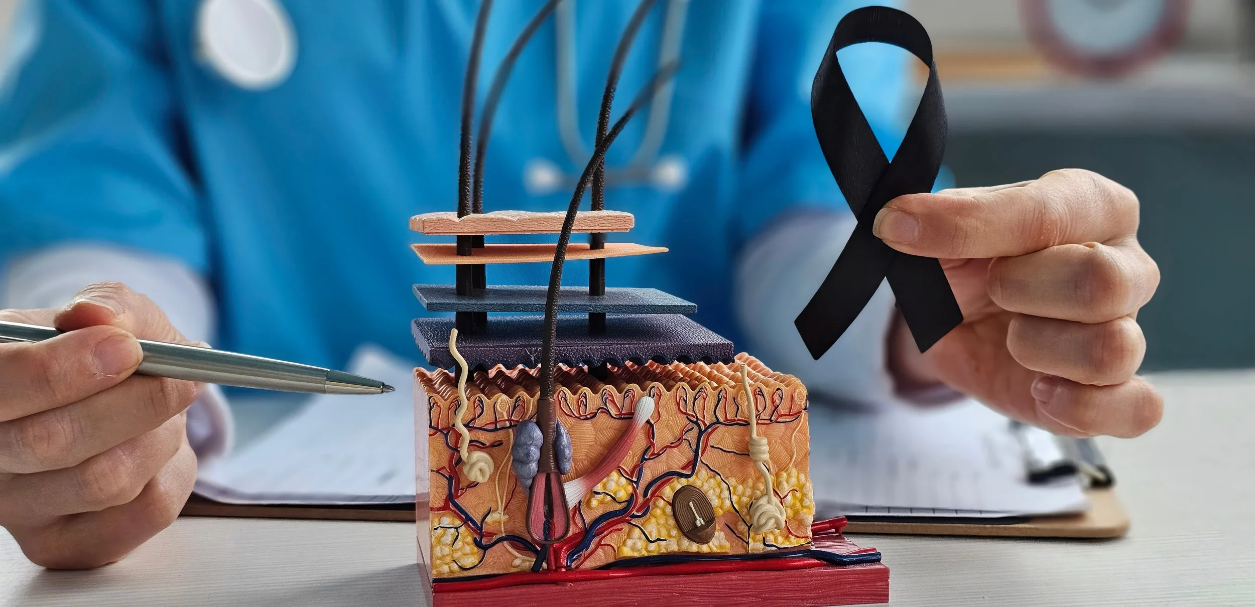 Melanoma Awareness Month!!