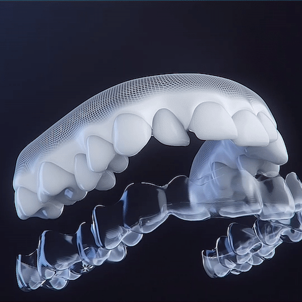 teeth___aligner_movement_CGI.GIF.gif