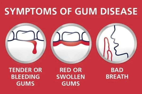 Gum Disease Awareness Month