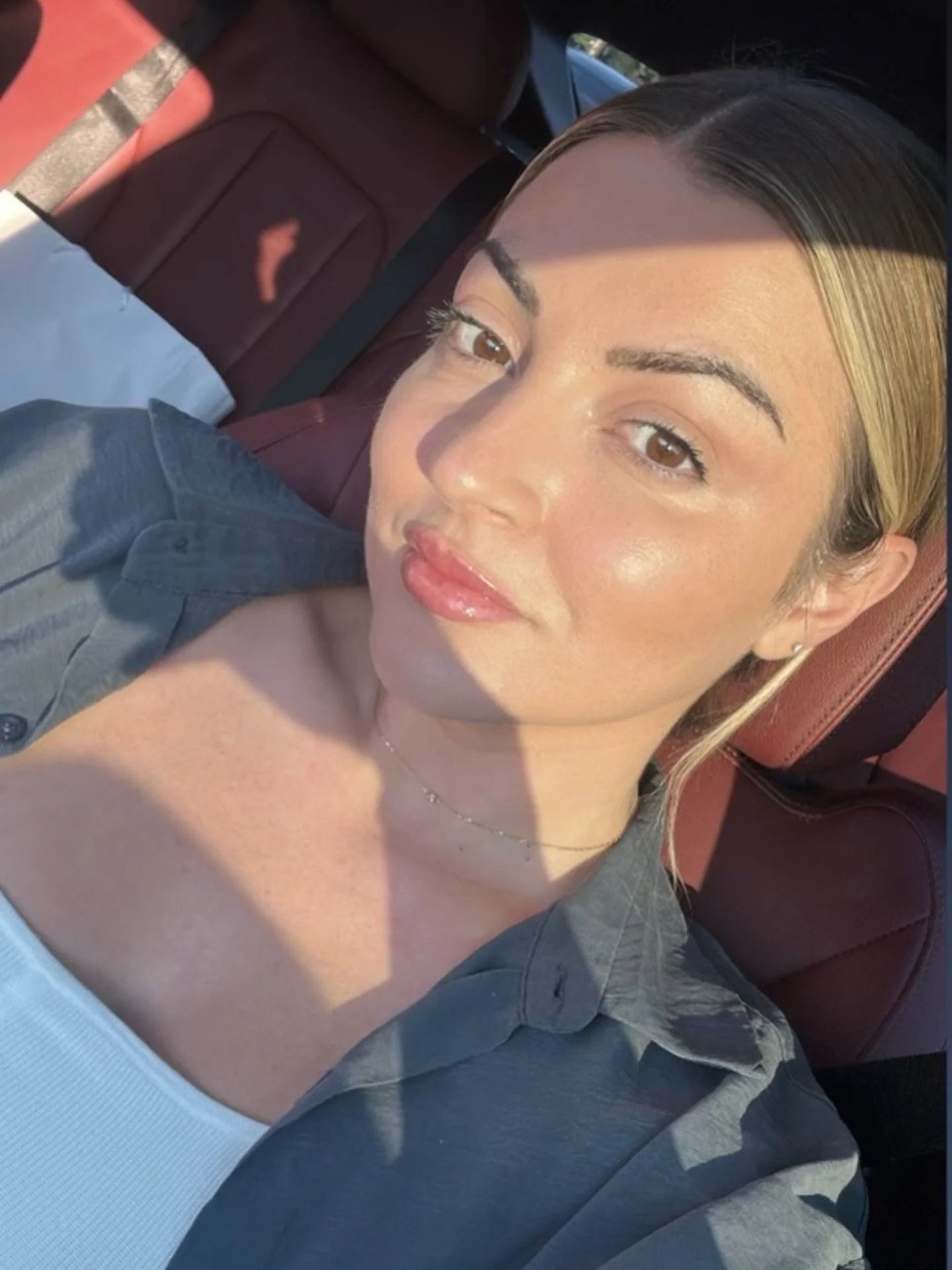 ✨ My gorgeous client selfie few days post-microneedling&hellip; hello, glass skin!
Wearing only sunscreen and powdered make up ✨ 

The glow is undeniable 💫 

Does your skin need a confidence boost? 
Any questions about medical-grade microneedling? ?