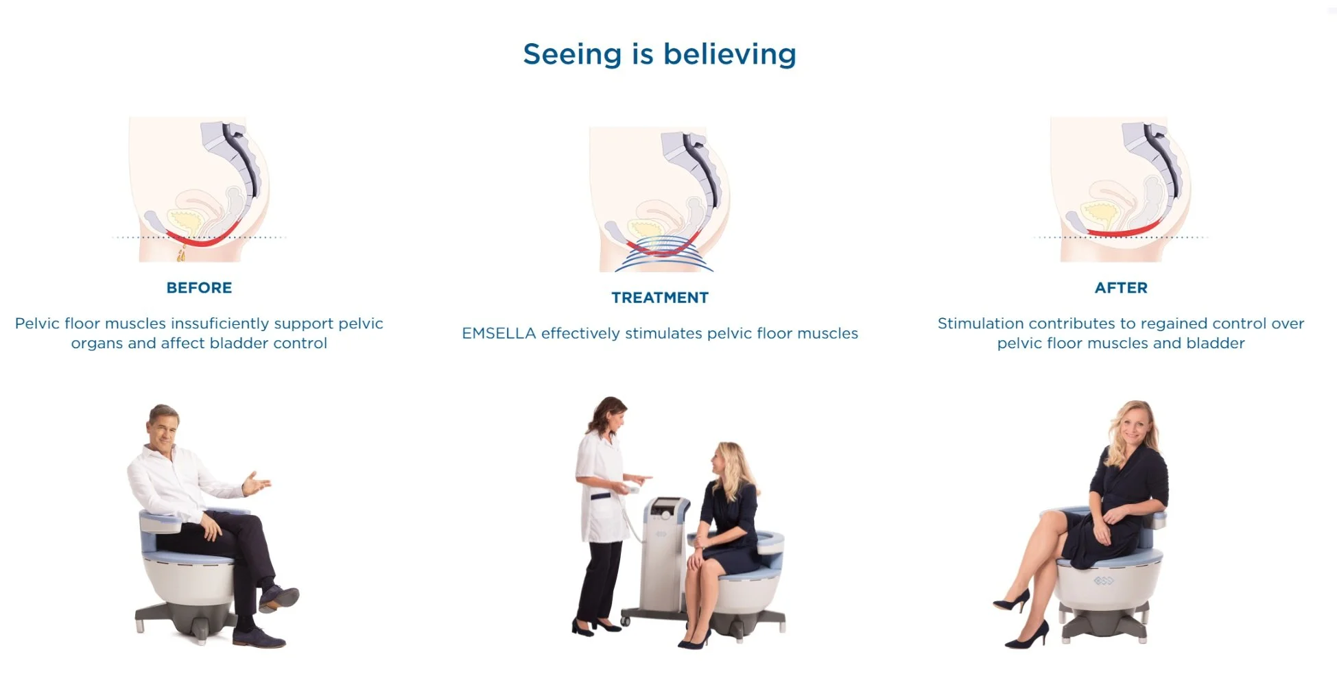How does EMSELLA work? — Linda's Wellness Clinic