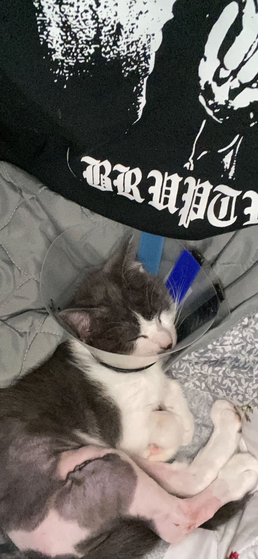 Broken 4 years old | Info: Thrown out of a moving vehicle, suffered leg injuries. Pins were placed to stabilize. All healthy now.