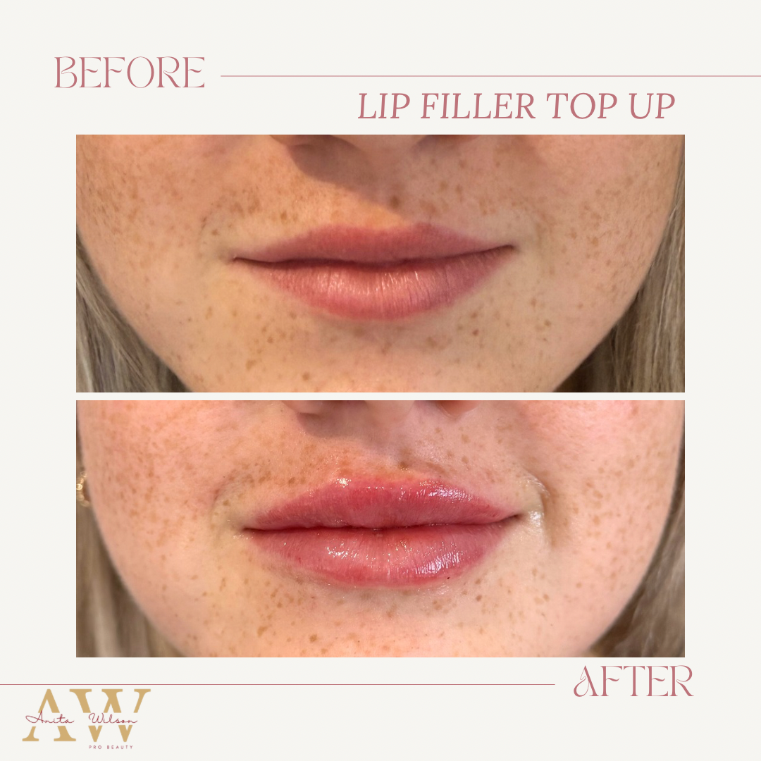 Before & after template.png