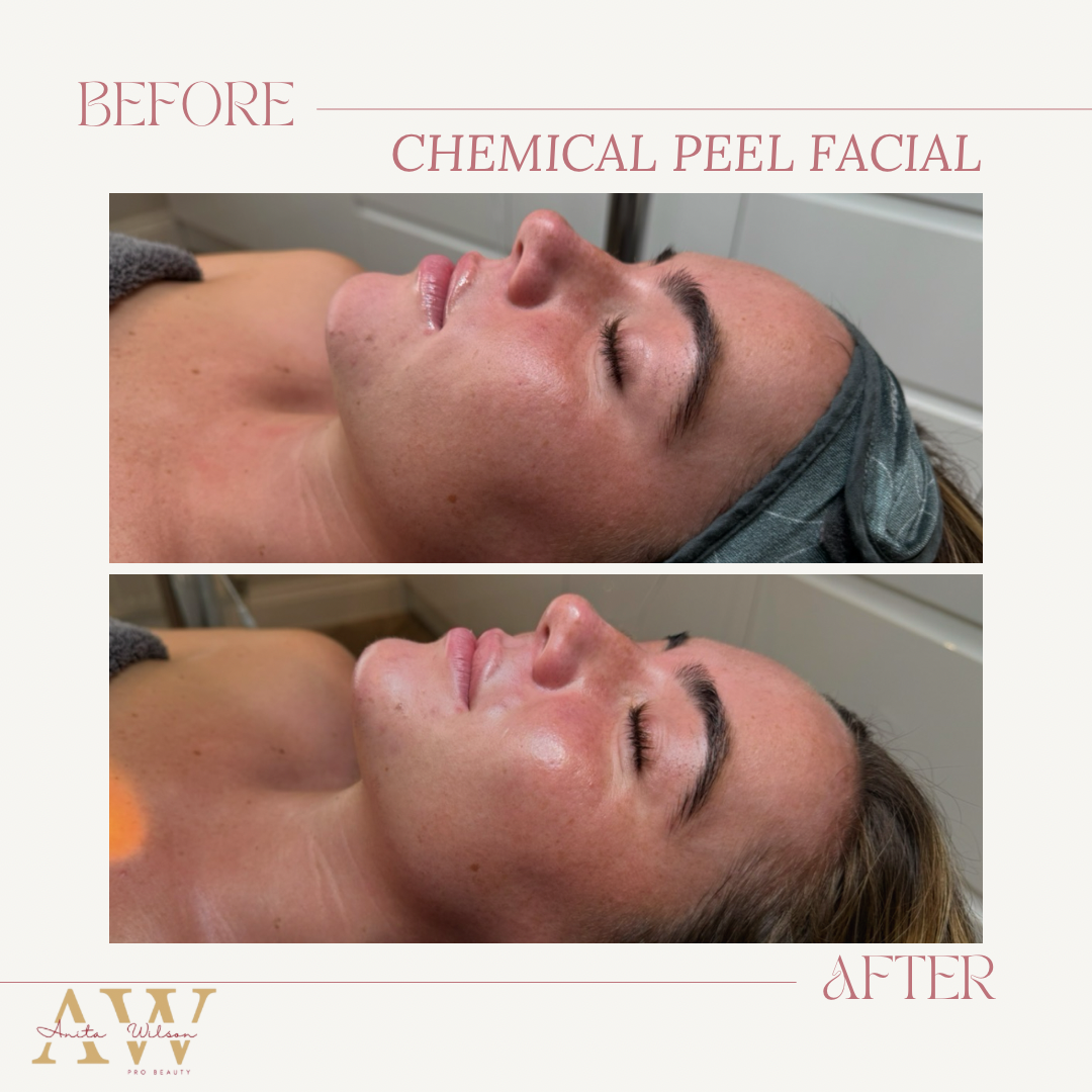 Before & after template.png