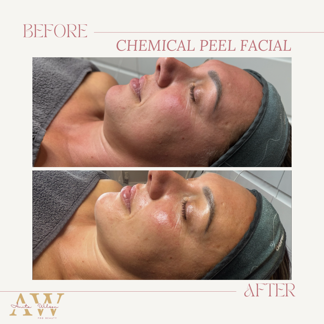 Before & after template.png