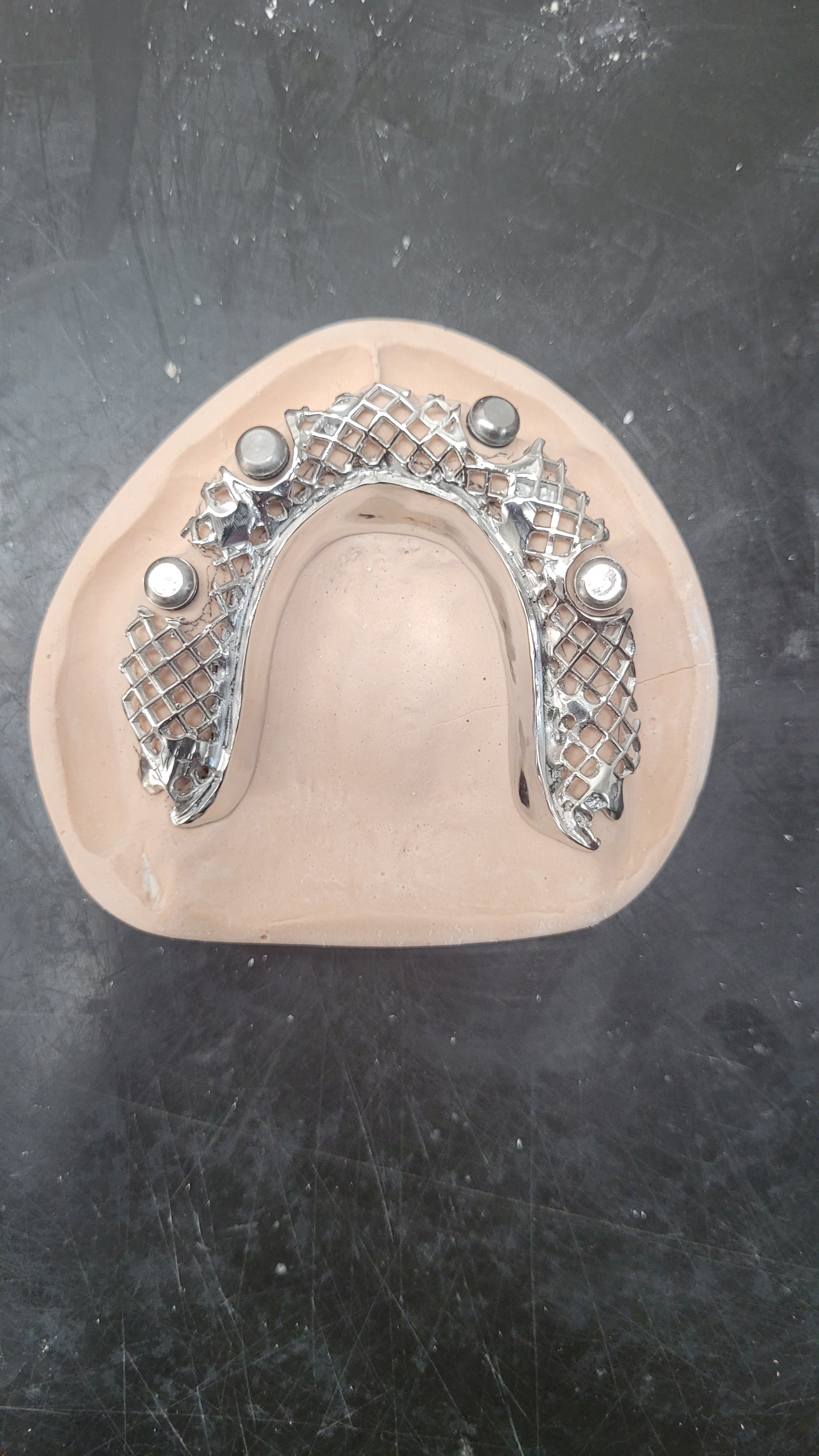 Implant Denture 11.jpg