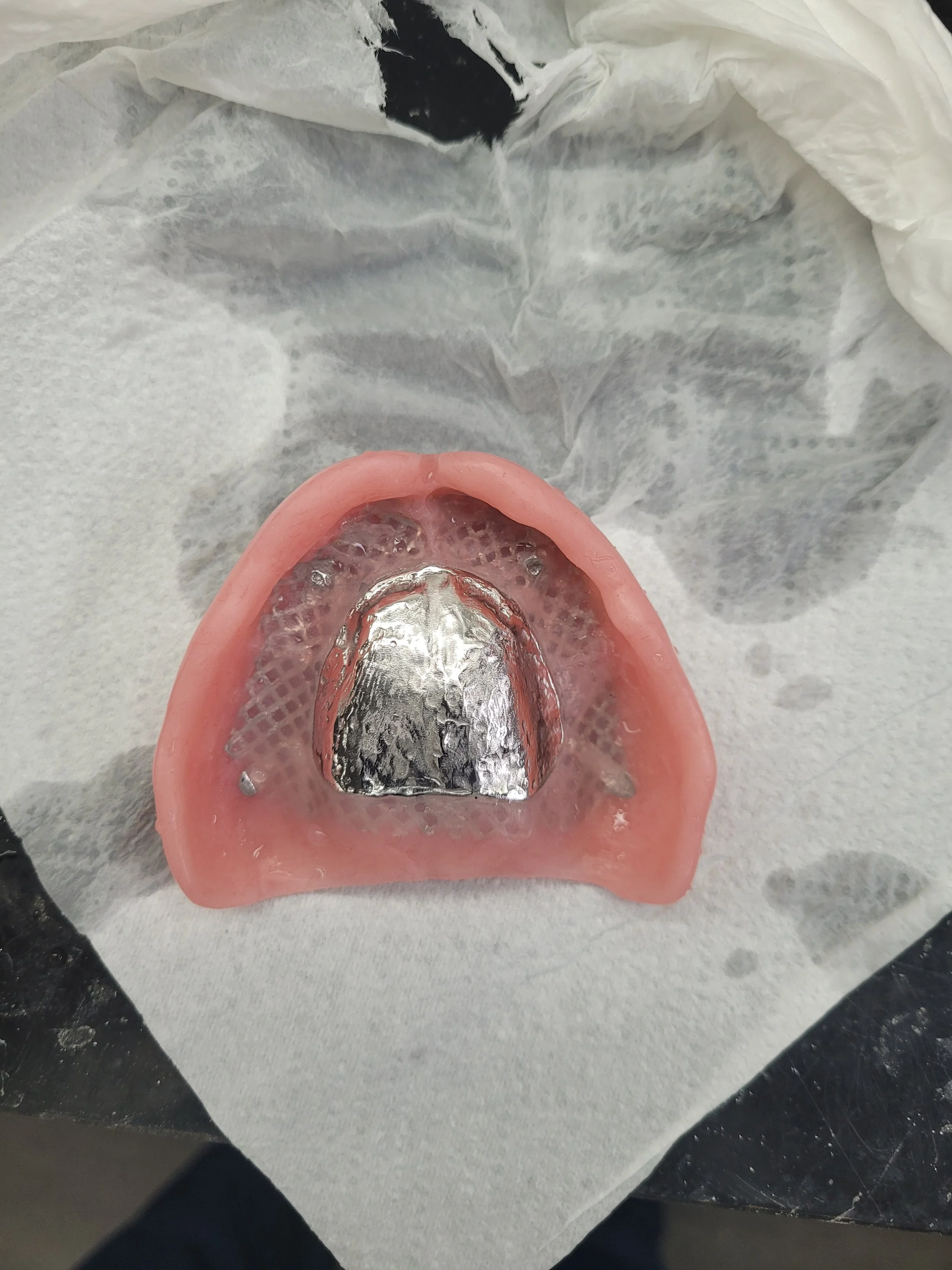 Reinforced Denture 3.jpg