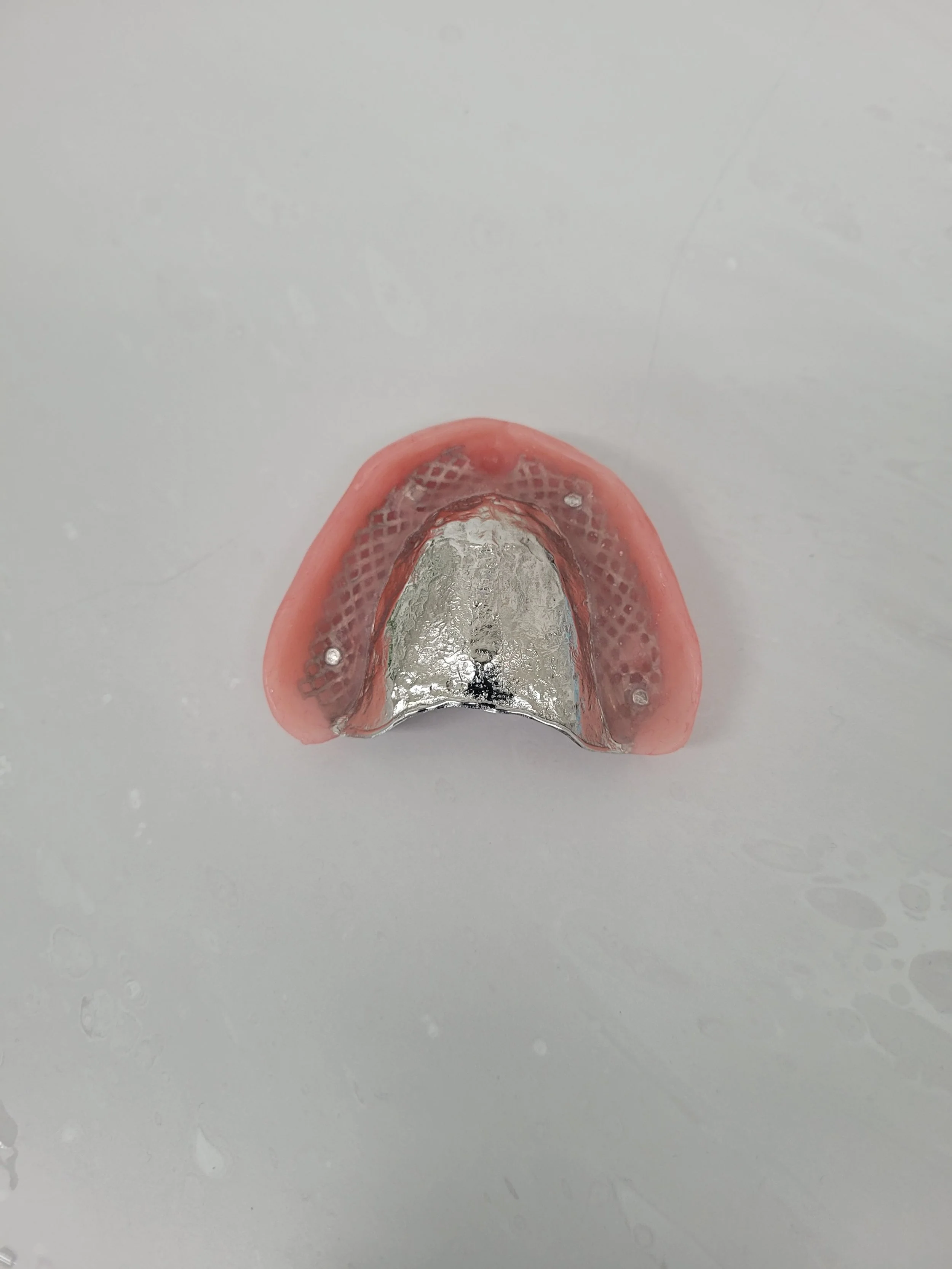 Reinforced Denture 5.jpg