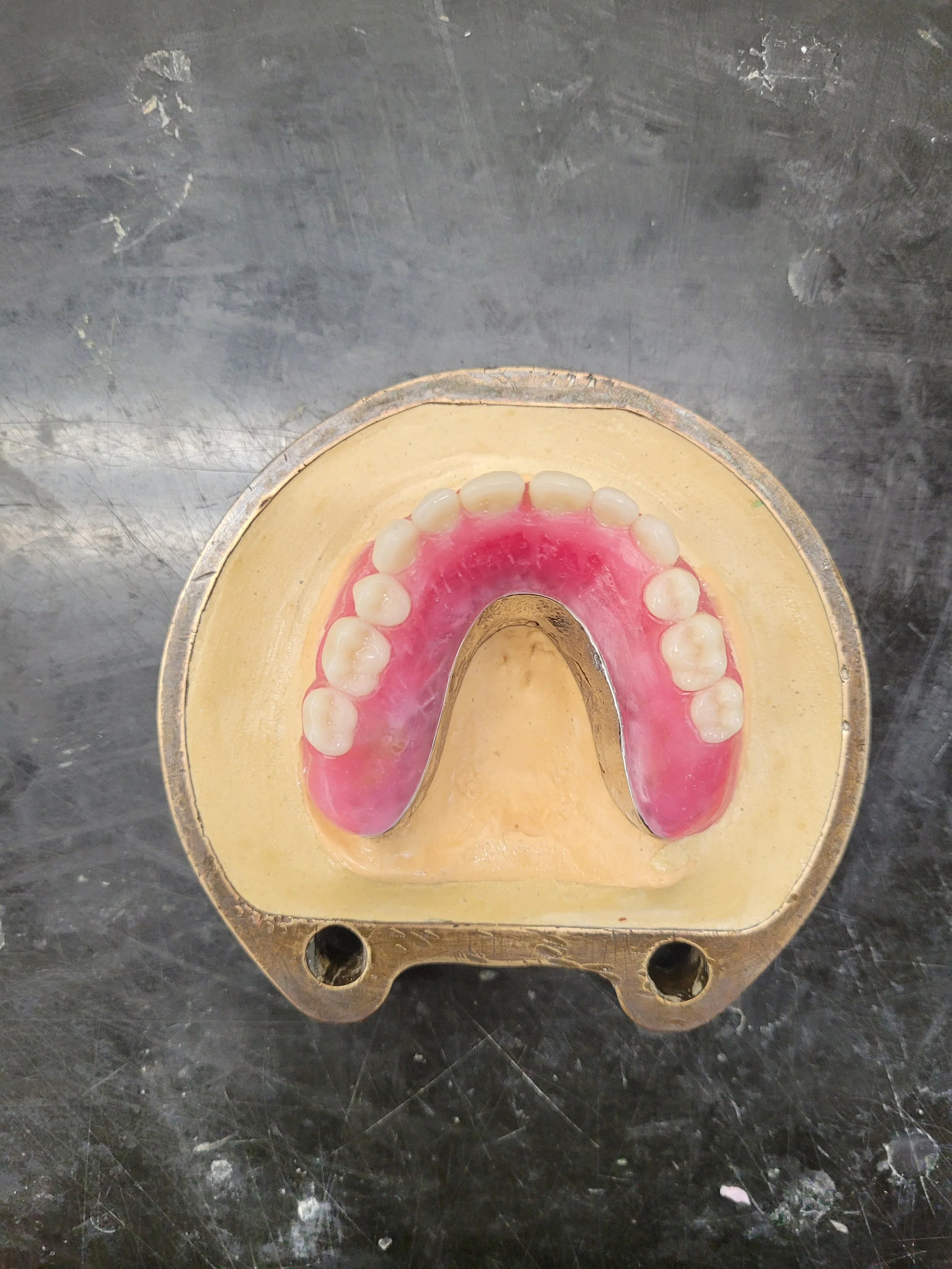 Implant Denture 6.jpg