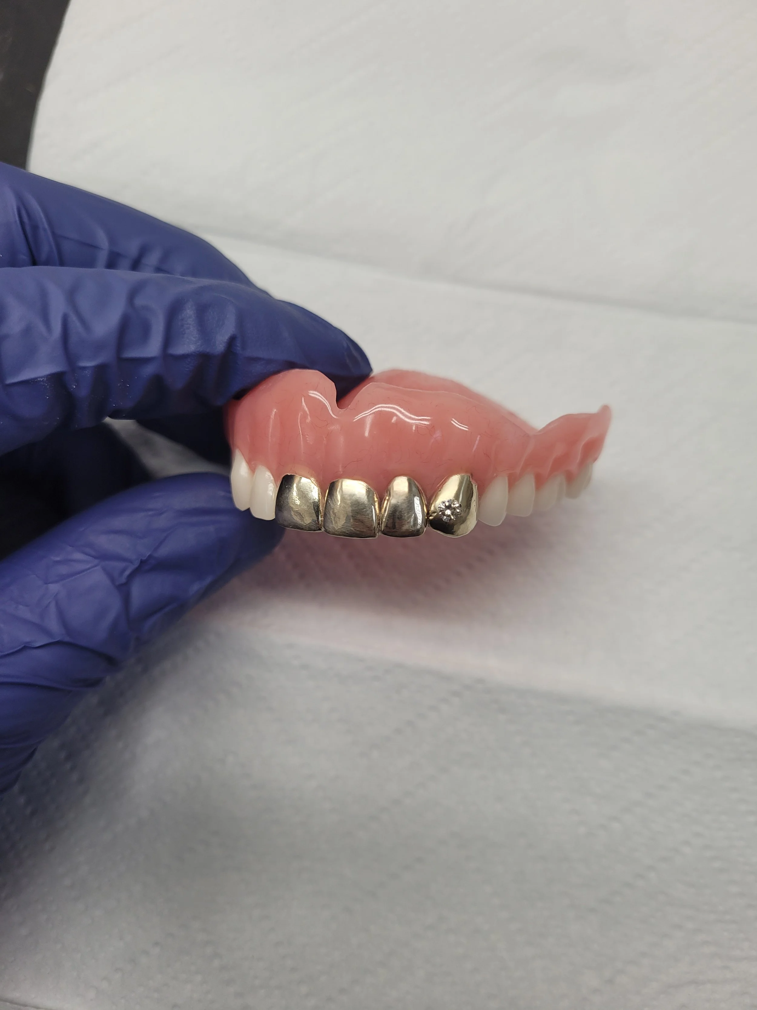 Complete Denture 3.jpg