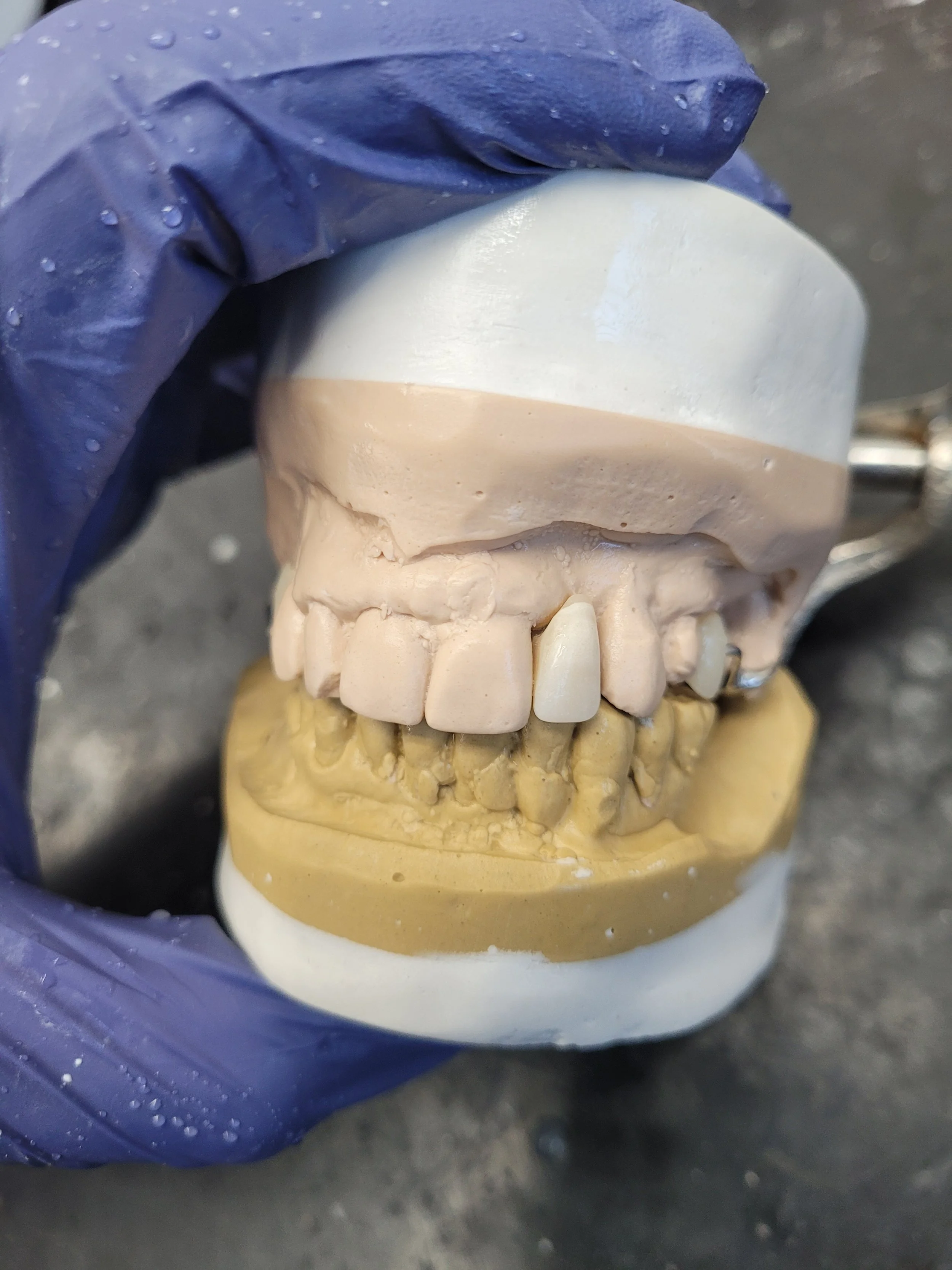 Partial Denture 2.jpg