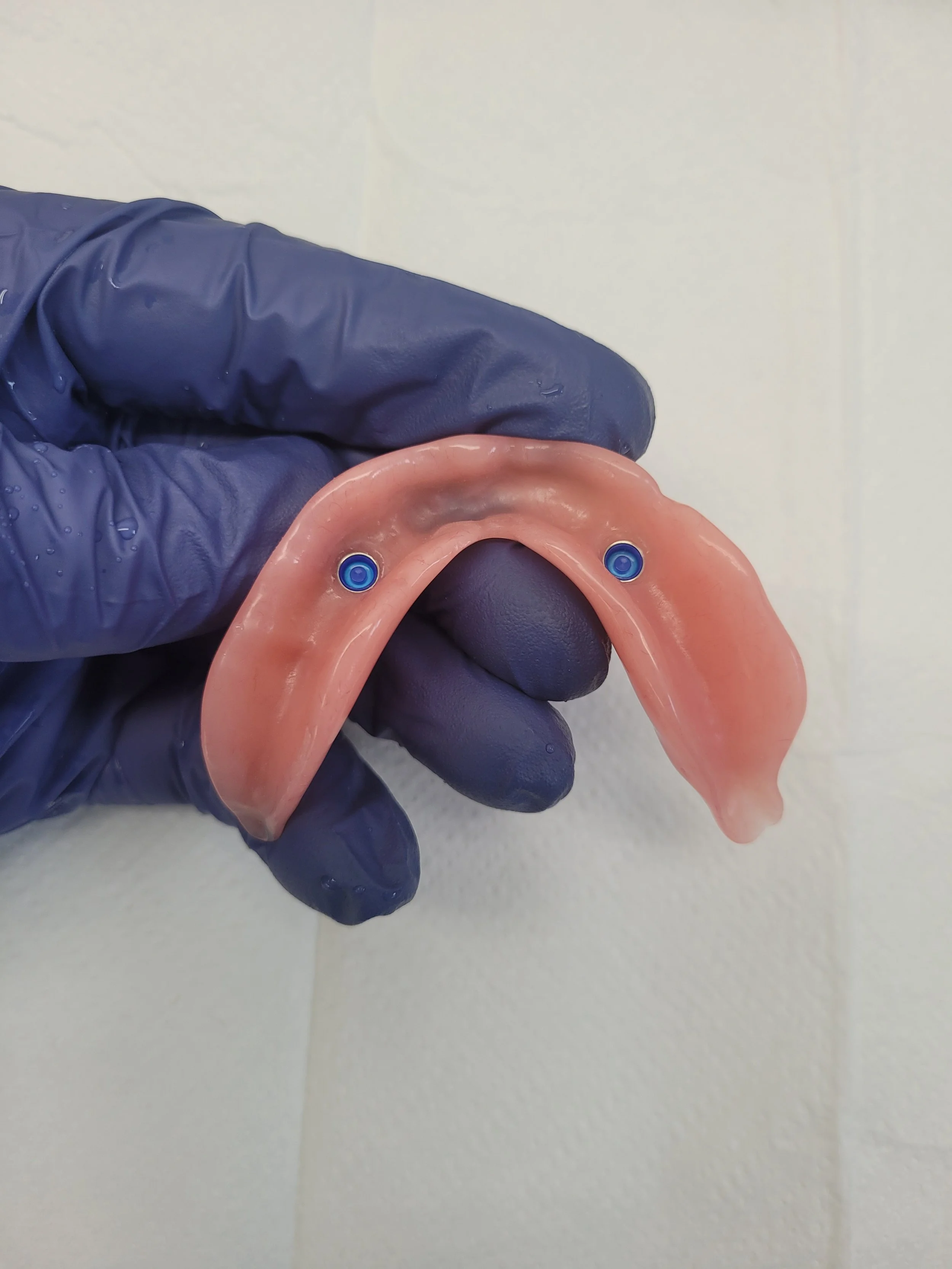 Implant Denture 15.jpg