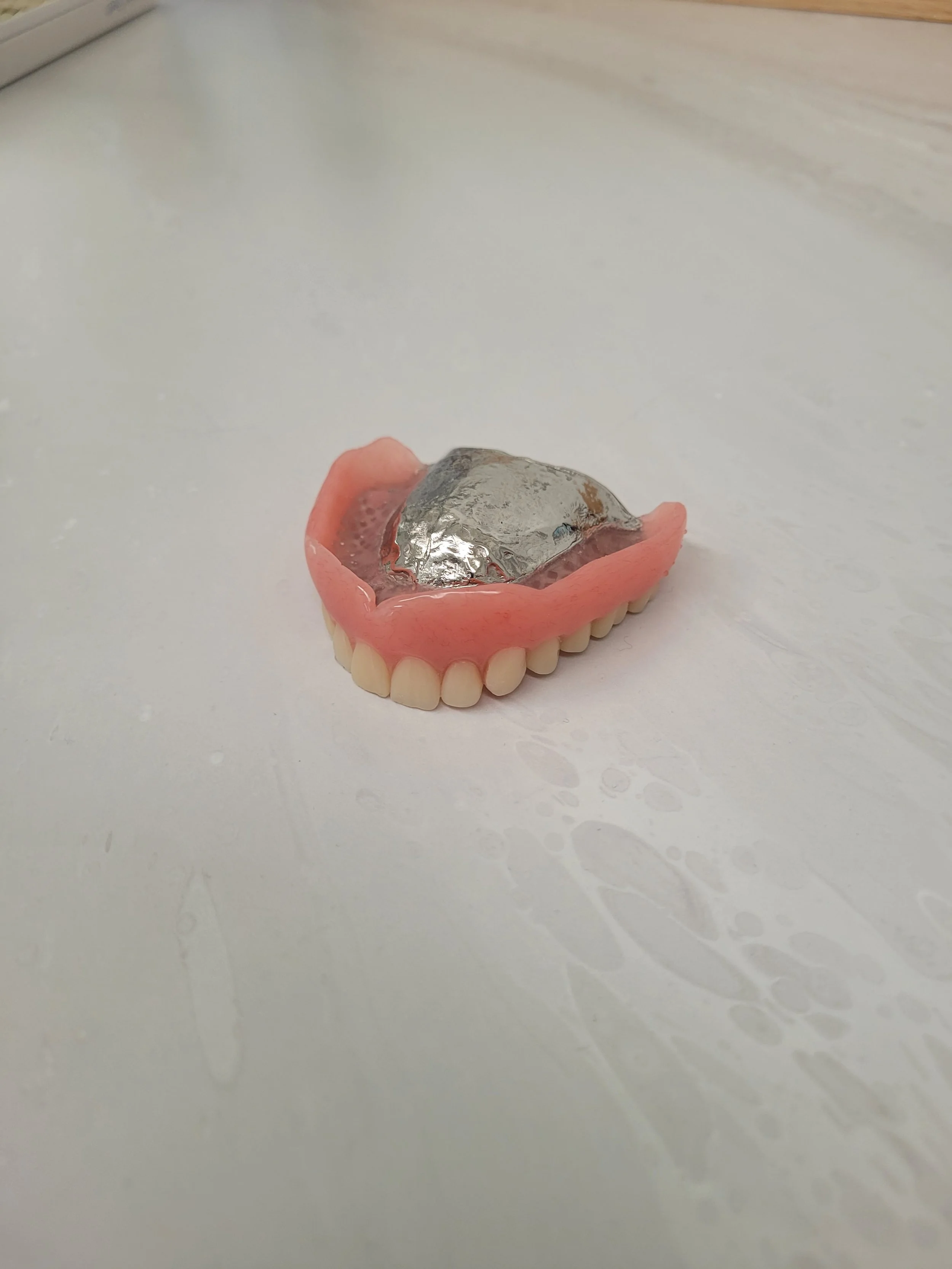 Reinforced Denture 6.jpg